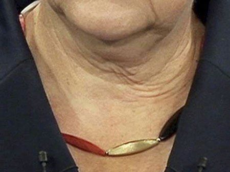 merkel1459 merkel1459