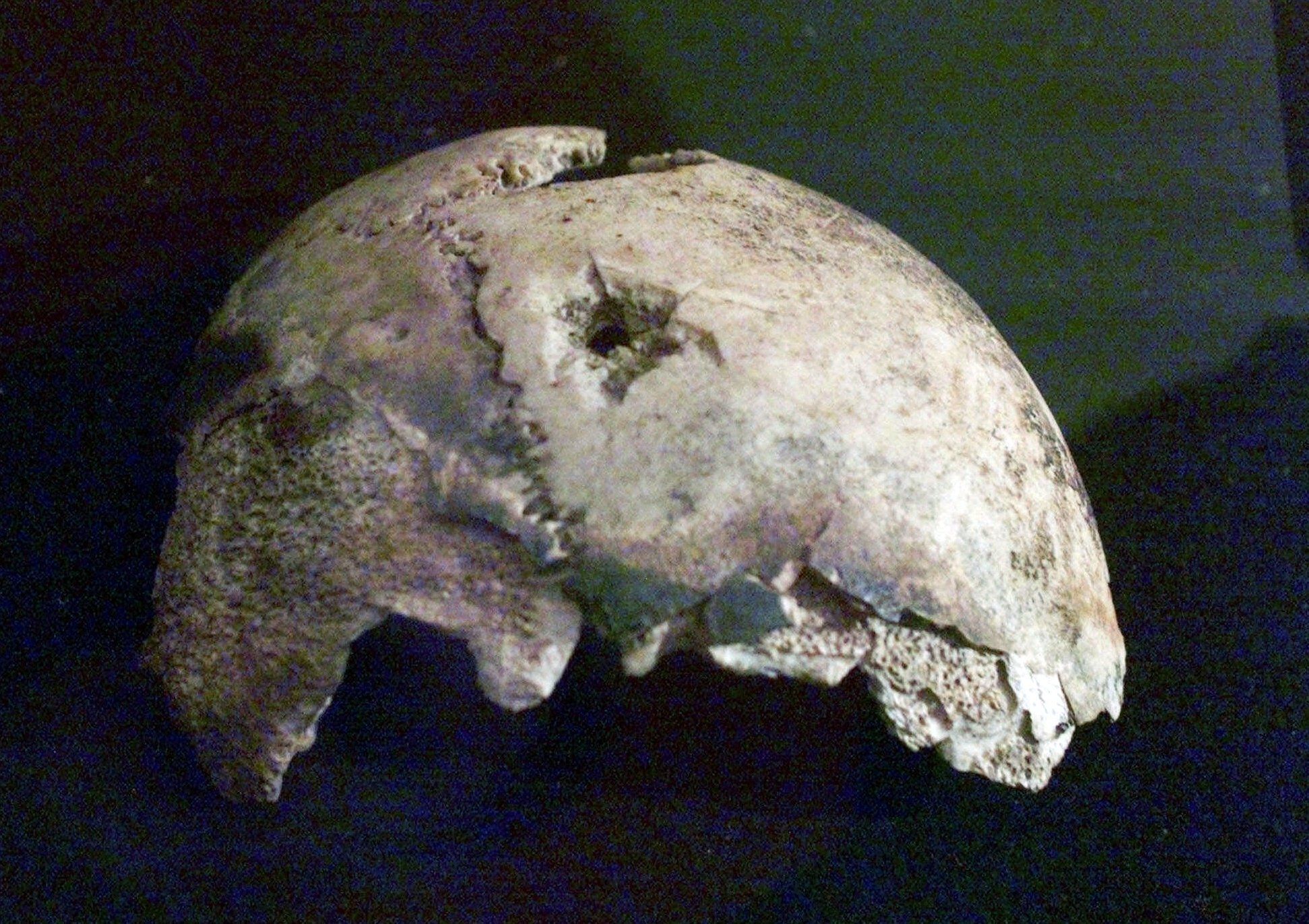 US Russia Hitlers Skull