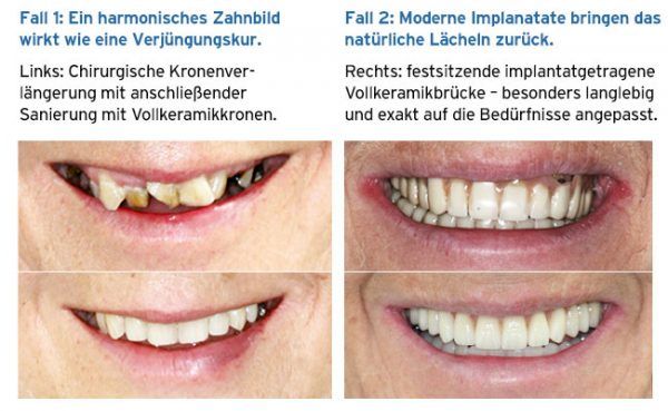 Vorher/Nachher-Situation zwei Patientenfälle 