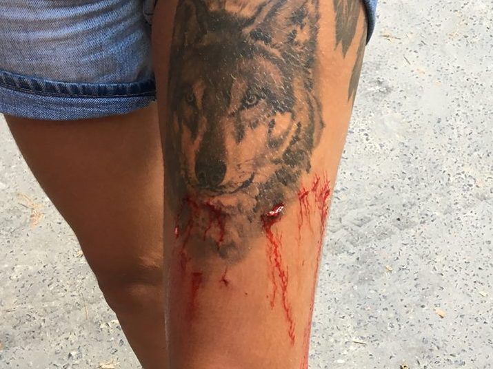 Die Urlauberin kam mit leichten Verletzungen davon. Die Urlauberin kam mit leichten Verletzungen davon.