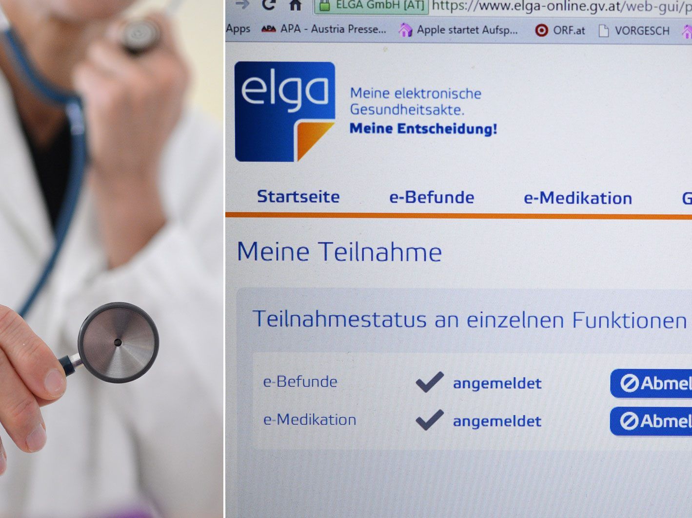 Die niedergelassenen Ärzte kritisieren, dass ELGA ein lückenhaftes Werk sei und die Aufklärungsarbeit etwa im Bereich der Psychiatrie viel Zeit erfordere. Die niedergelassenen Ärzte kritisieren, dass ELGA ein lückenhaftes Werk sei und die Aufklärungsarbeit etwa im Bereich der Psychiatrie viel Zeit erfordere.