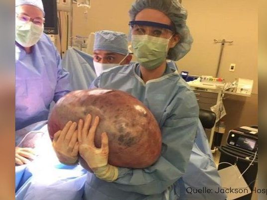 Der Frau musste ein 22-Kilo-Tumor entfernt werden.