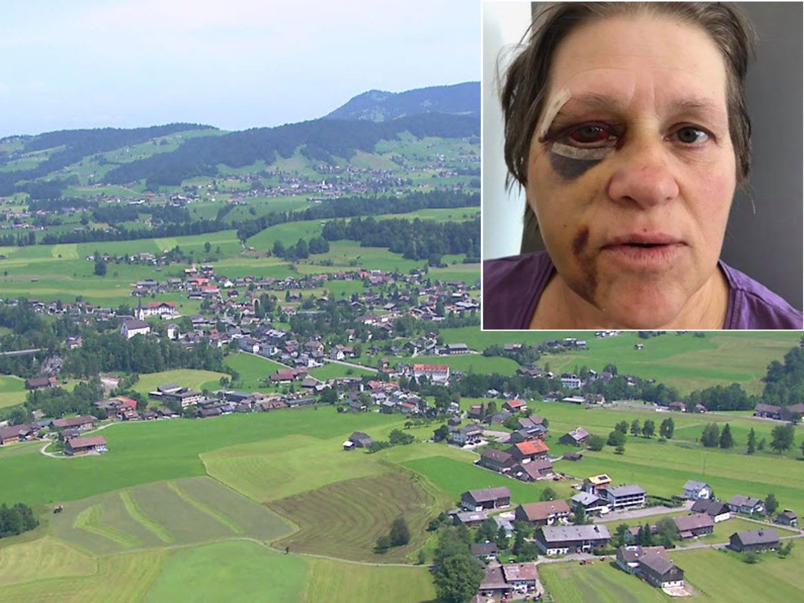 Frau erlitt schwere Verletzungen Frau erlitt schwere Verletzungen