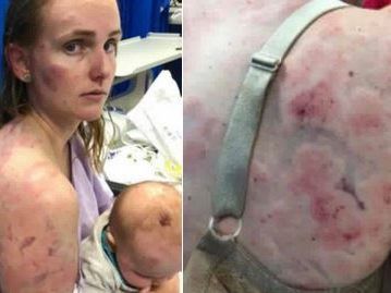 Warf sich heldenhaft über ihr Kind: Die Australierin Fiona Simpson. Warf sich heldenhaft über ihr Kind: Die Australierin Fiona Simpson.