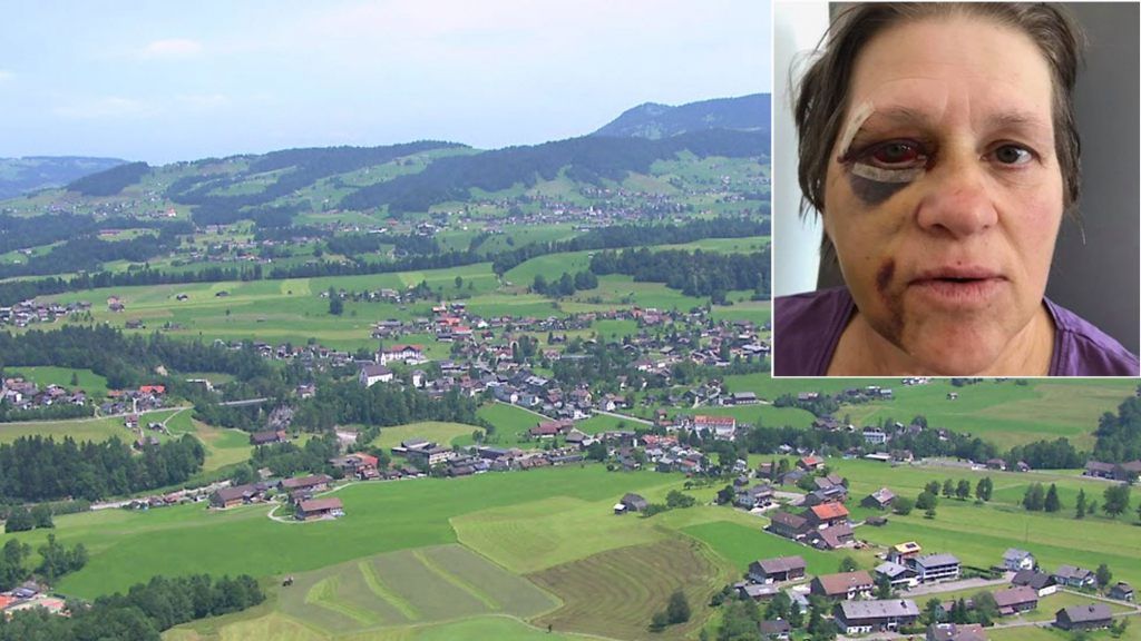 Die Frau erlitt schwere Verletzungen. Die Frau erlitt schwere Verletzungen.