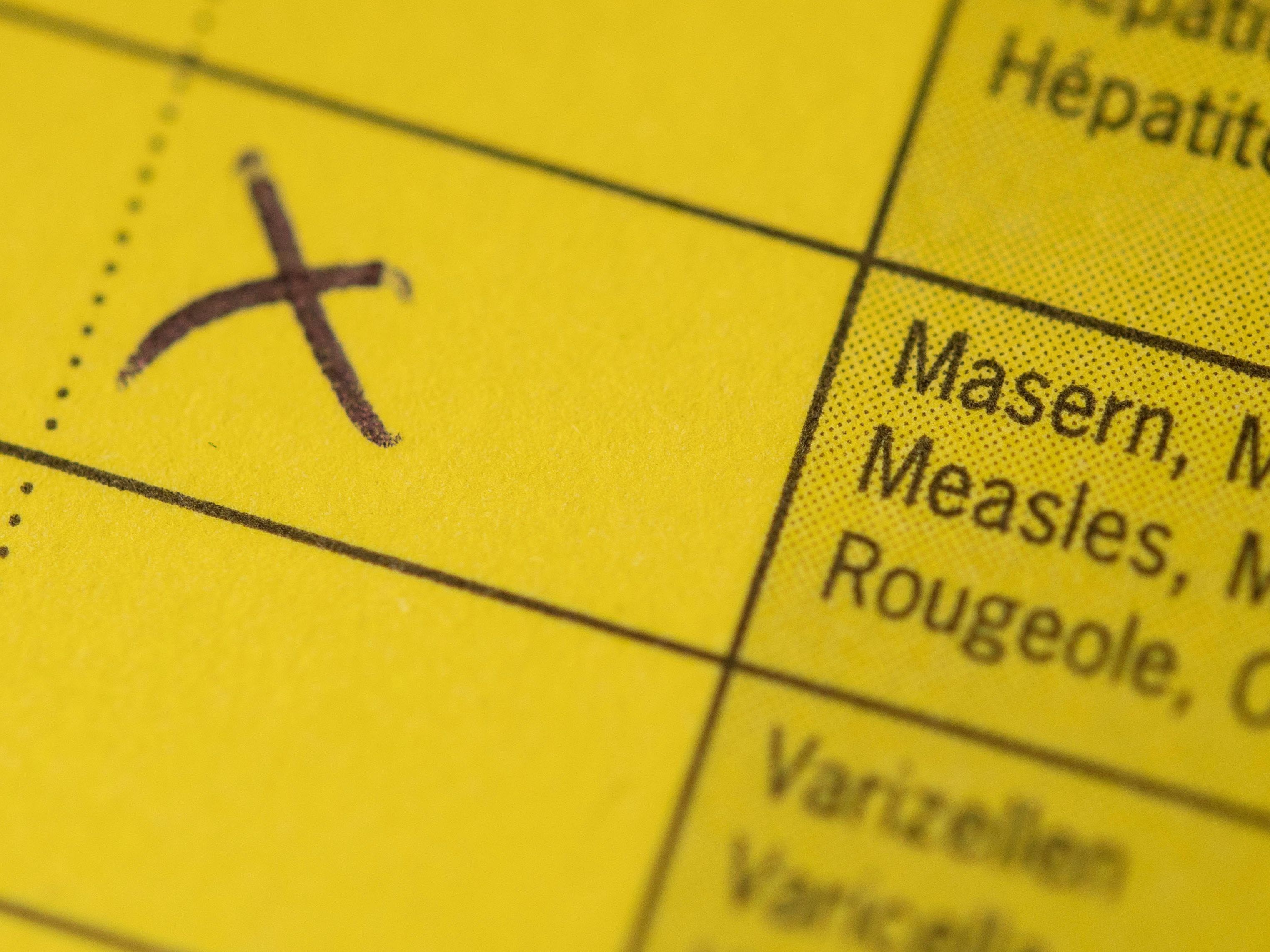 In Niederösterreich wurden fünf Maser-Fälle bestätigt. In Niederösterreich wurden fünf Maser-Fälle bestätigt.