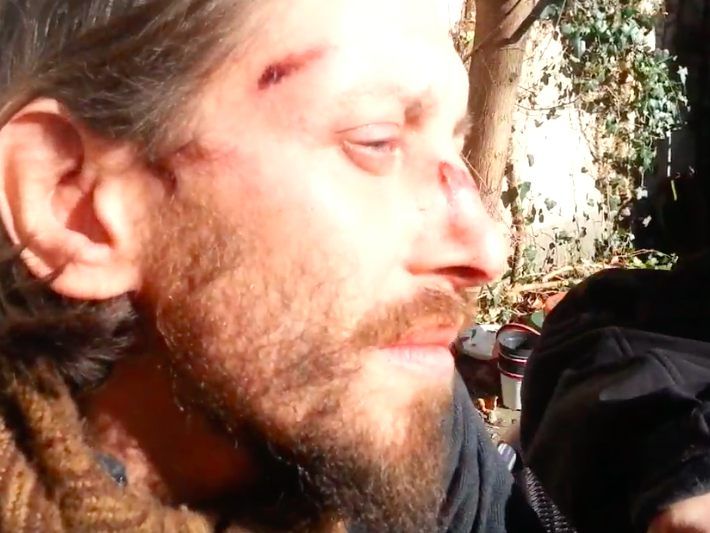 Das Opfer zeigt seine Gesichtsverletzungen.
