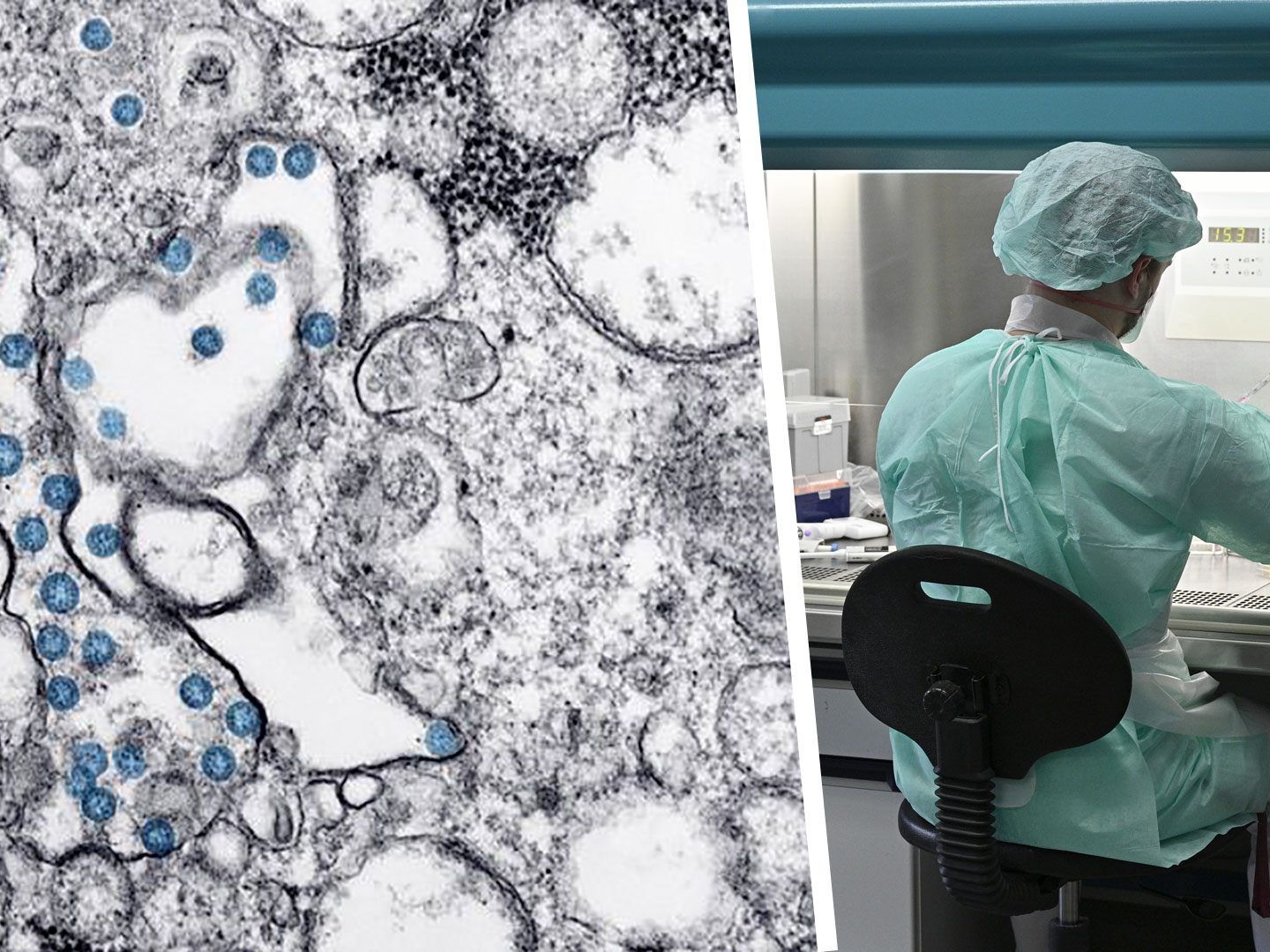 Coronavirus - ETH in Basel errechnete Ursprünge des Virus