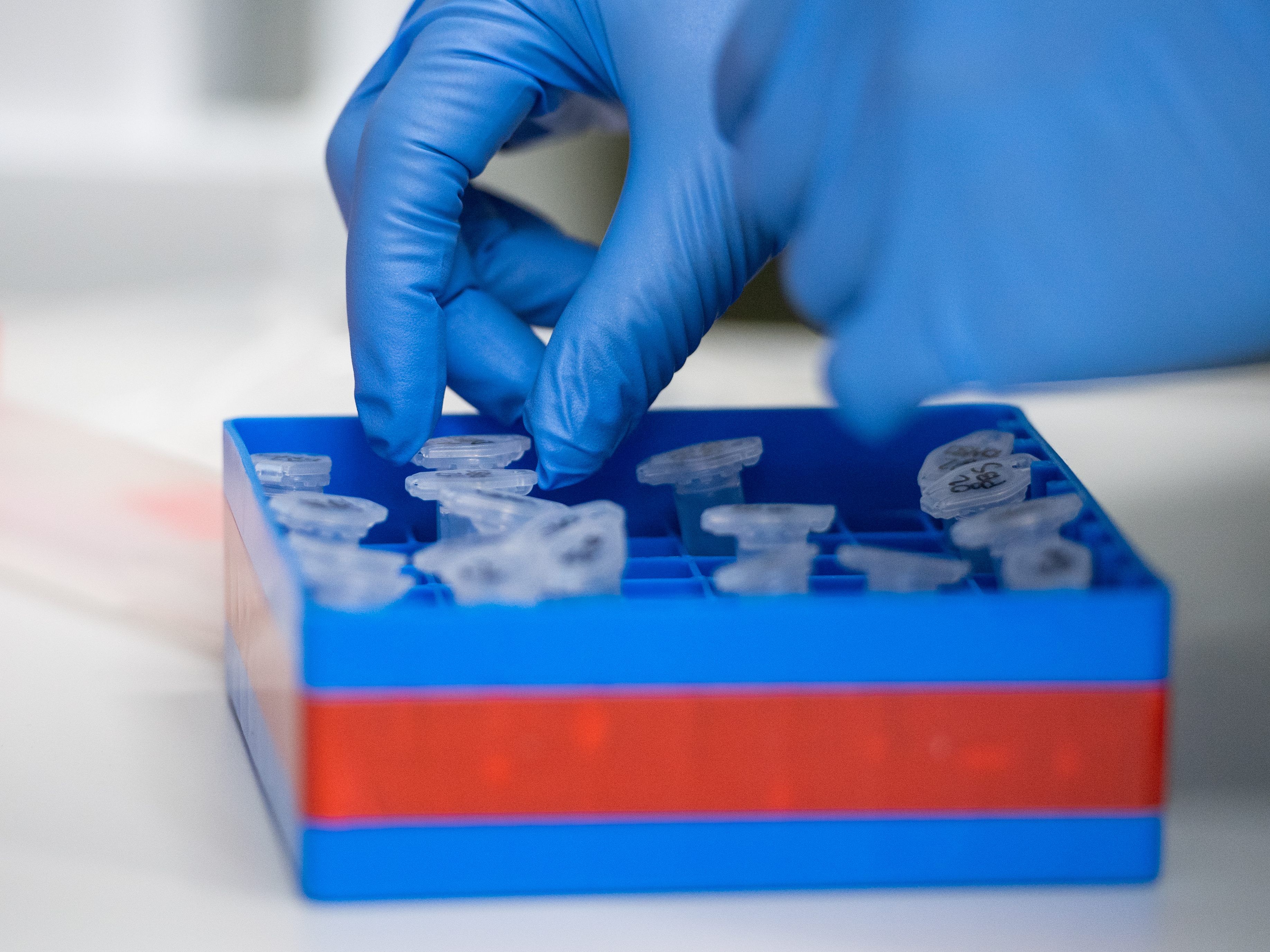 Insgesamt wurden in NÖ seit Montag 450 Tests ausgewertet.