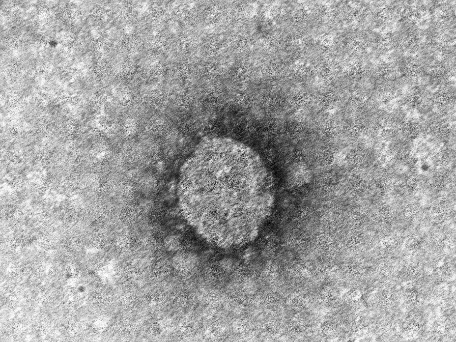 So sieht der österreichische Coronavirus-Erreger aus. So sieht der österreichische Coronavirus-Erreger aus.