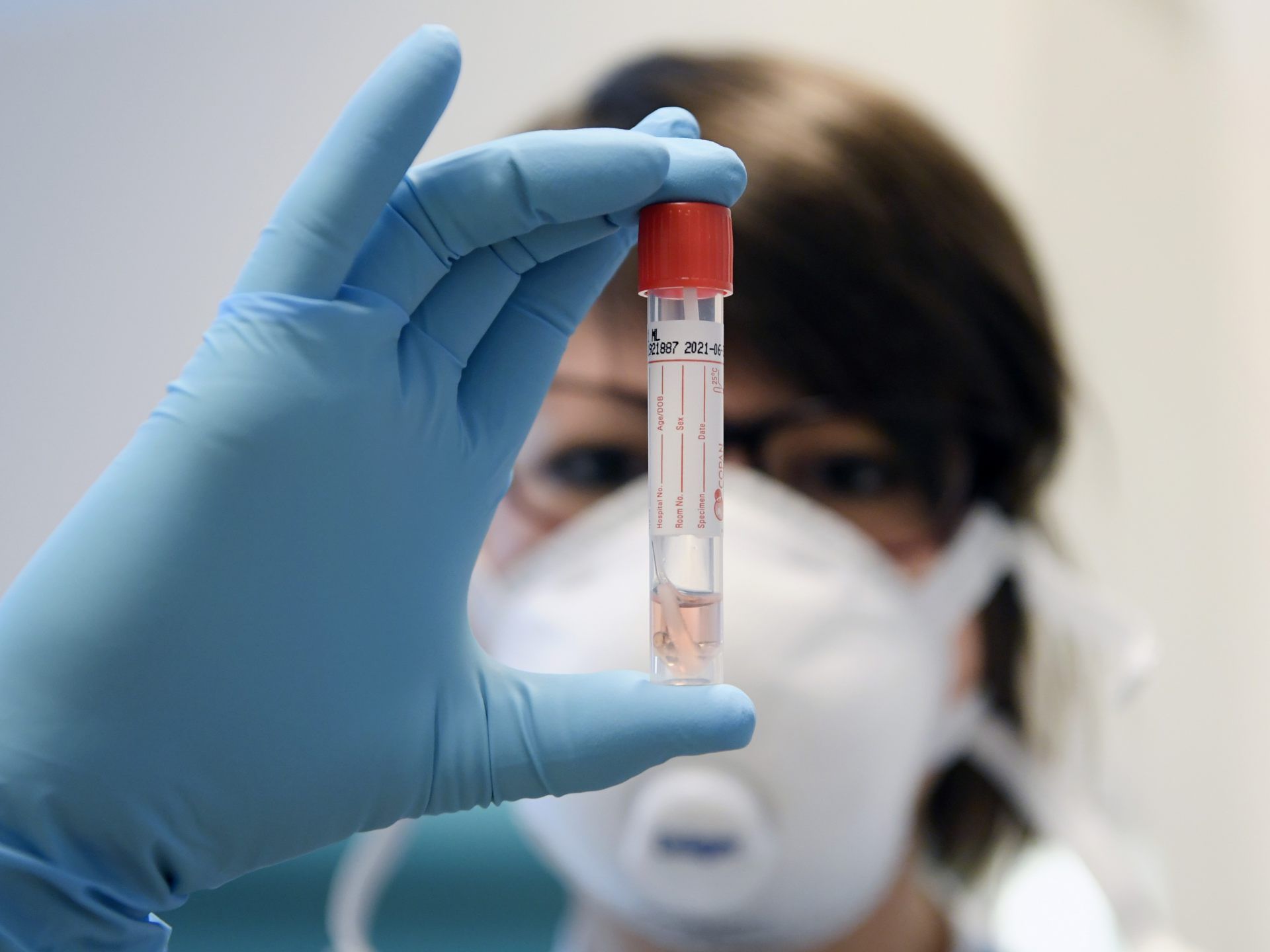 Коронавирус. Коронавирус колба. Covid 19 test. Заразился от теста. Заразился от теста.