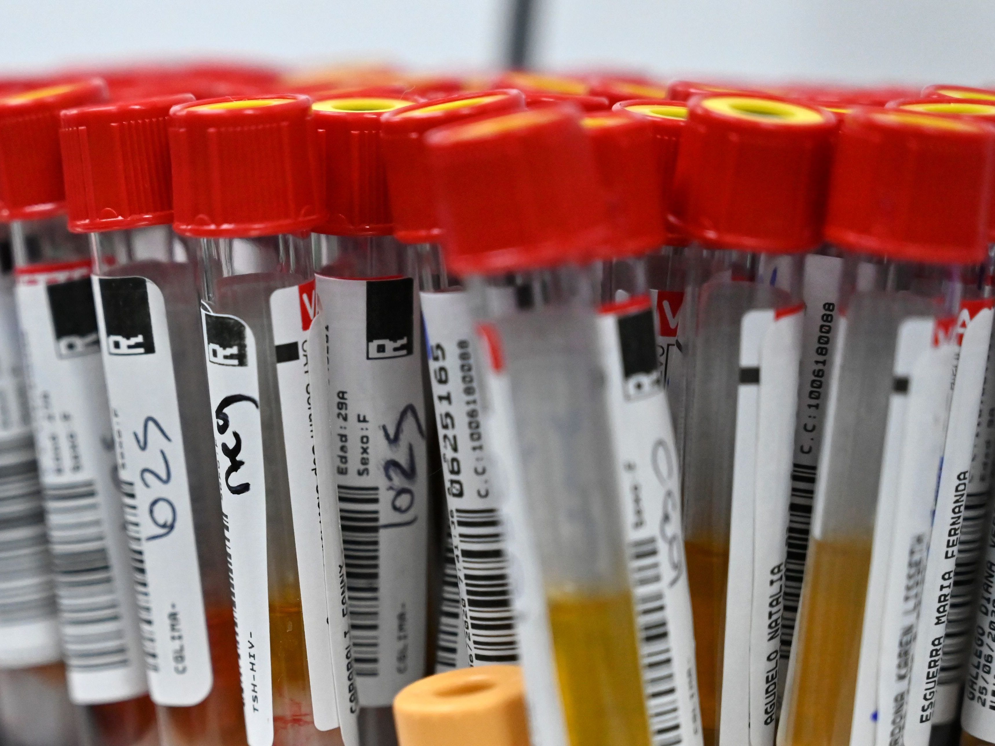 Tests bei 181 weiteren Menschen, die im Haus aufgenommen sind, seien negativ geblieben. Tests bei 181 weiteren Menschen, die im Haus aufgenommen sind, seien negativ geblieben.