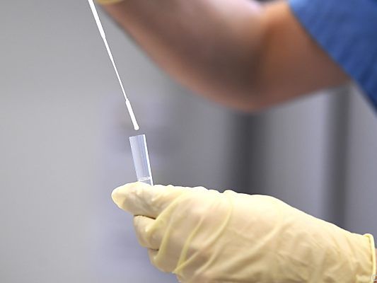 Erstmals mehr als 20.000 Tests innerhalb von 24 Stunden eingemeldet