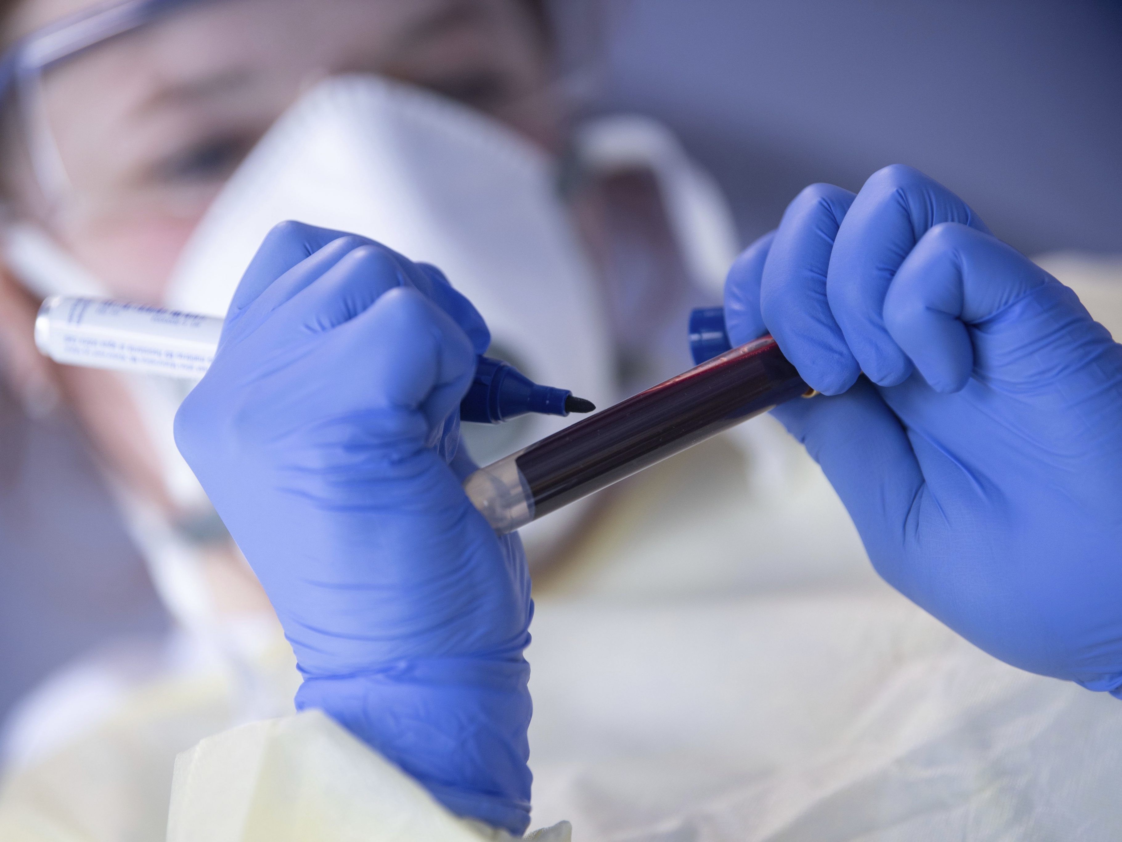 Schweizer Epidemiologe Marcel Salathé sieht Hoffnung.