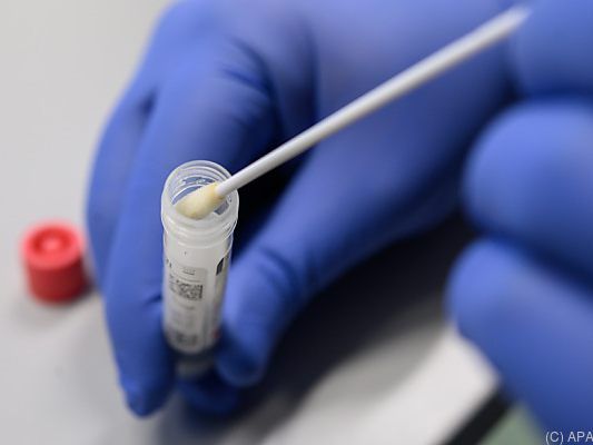 750 Neuinfektionen in den vergangenen 24 Stunden 750 Neuinfektionen in den vergangenen 24 Stunden