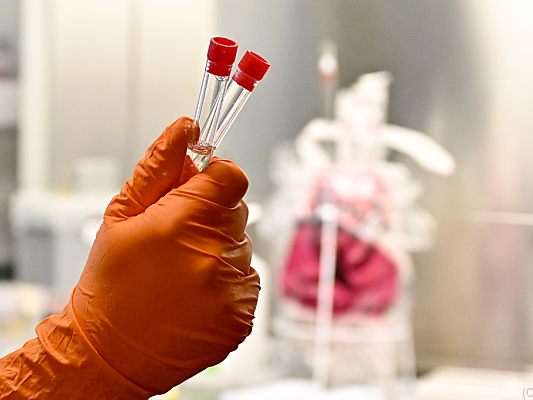 AGES bestätigt weitere südafrikanische Mutationsfälle in Tirol AGES bestätigt weitere südafrikanische Mutationsfälle in Tirol