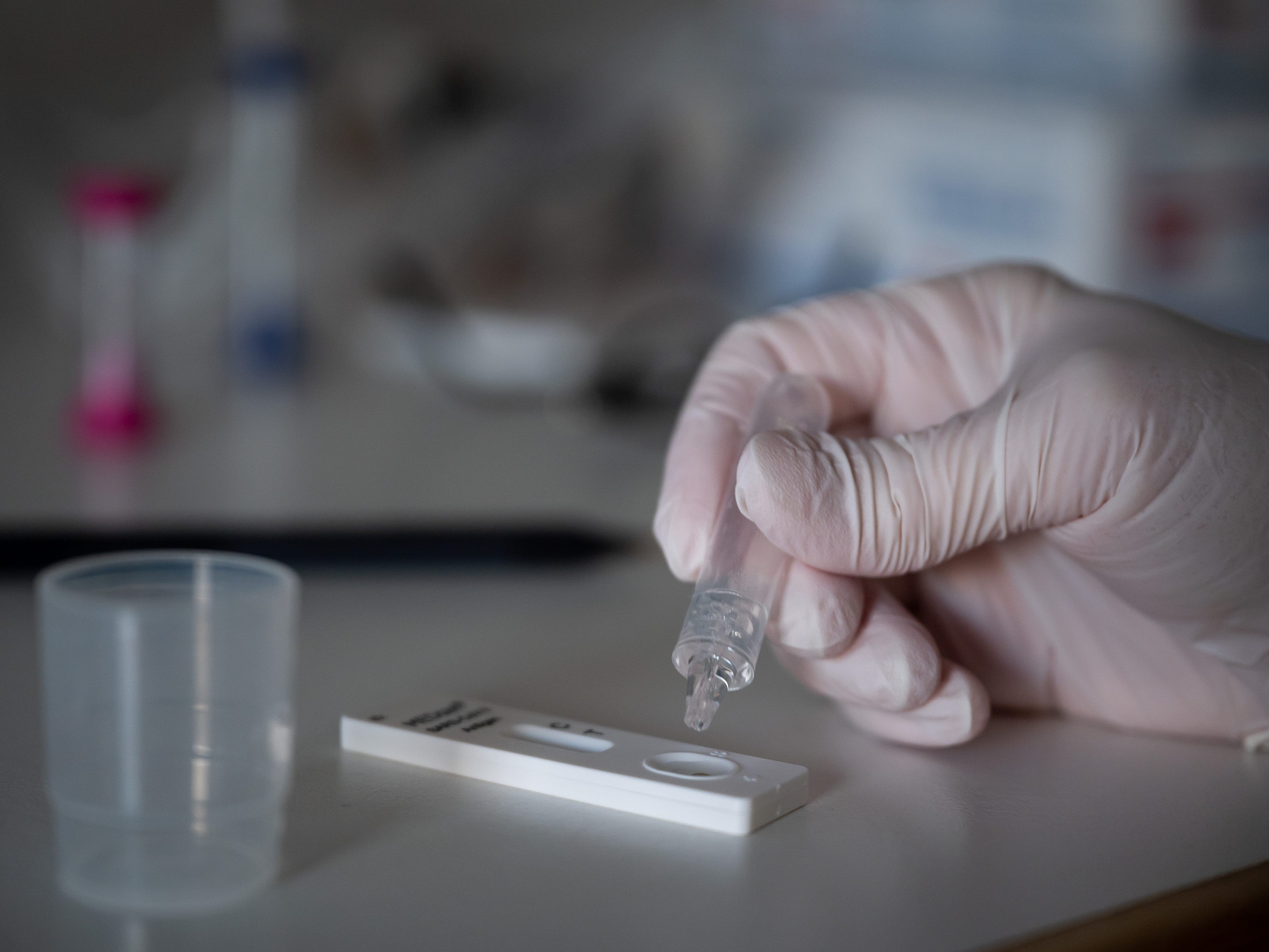 Die Tests werden kostenlose durchgeführt.