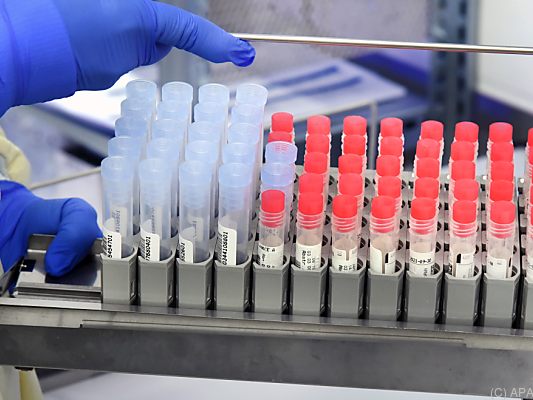 Auch Anteil positiver PCR-Tests angestiegen Auch Anteil positiver PCR-Tests angestiegen
