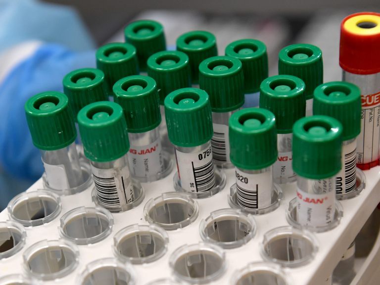 In Österreich wurden am Mittwoch 445 Coronavirus-Neuinfektionen gemeldet. In Österreich wurden am Mittwoch 445 Coronavirus-Neuinfektionen gemeldet.