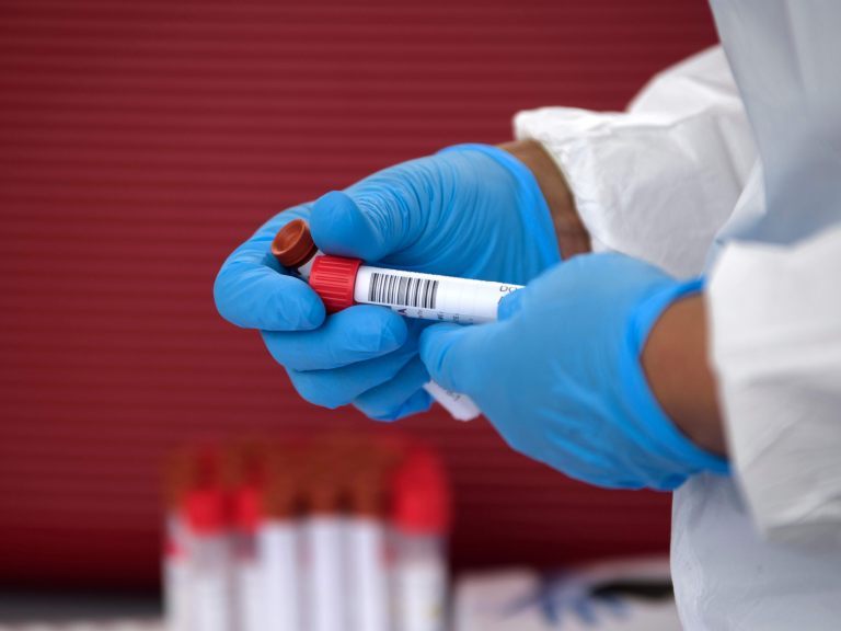 In Niederösterreich wurden am Montag 56 Coronavirus-Neuinfektionen gemeldet.