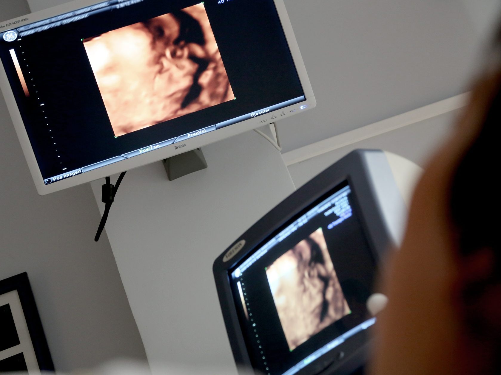 Ultraschallgeräte wurden etwa ohne Ausschreibung angeschafft. Ultraschallgeräte wurden etwa ohne Ausschreibung angeschafft.