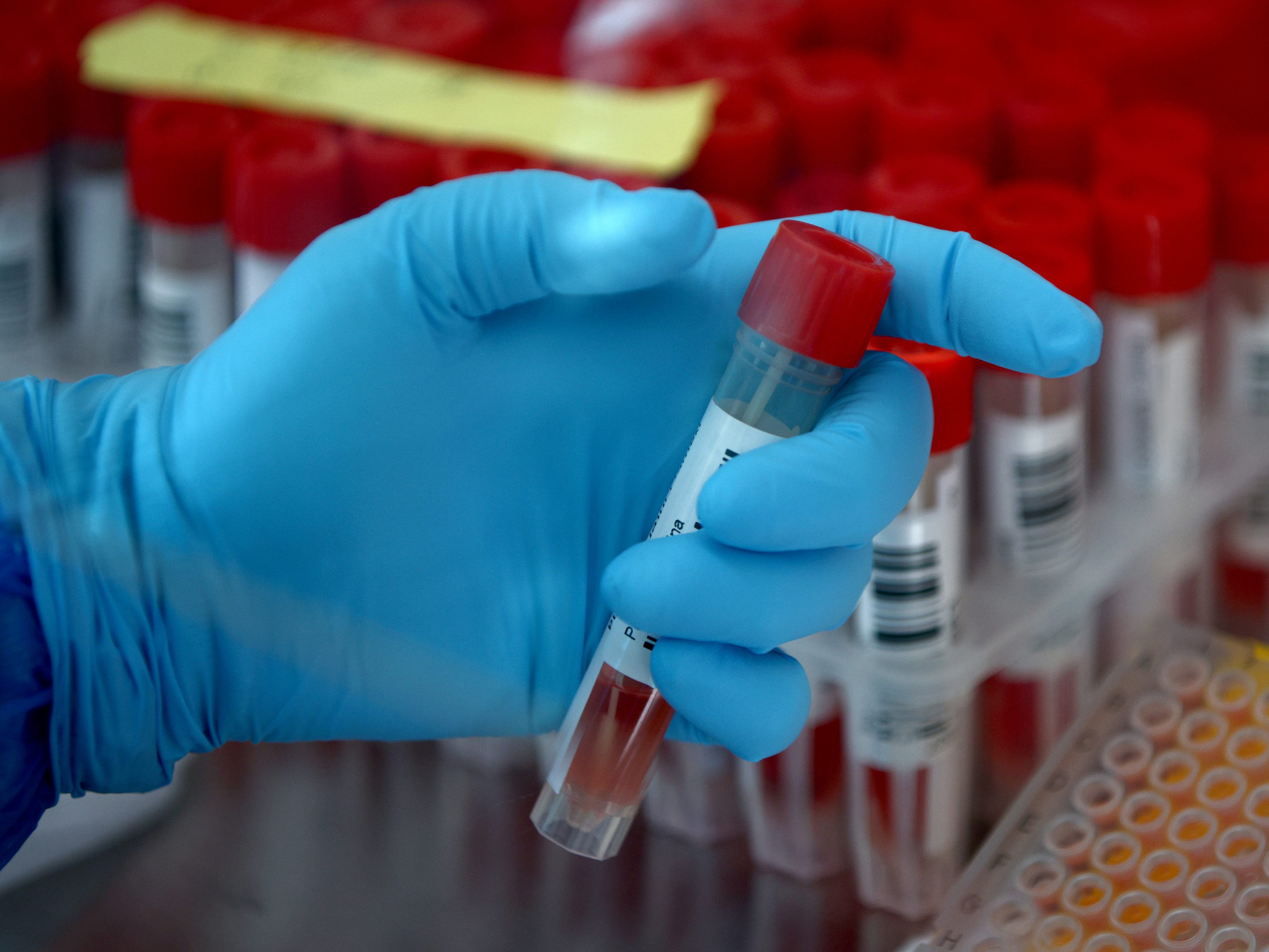 Sechs Personen hatten sich mit dem Coronavirus infiziert.
