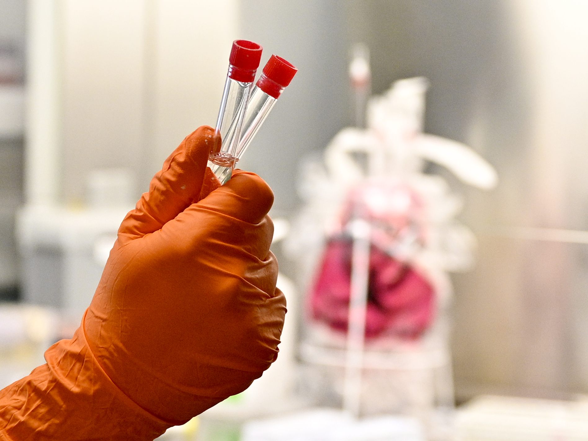 Am Montag wurden 312 neue Coronavirus-Fälle in Österreich gemeldet. Am Montag wurden 312 neue Coronavirus-Fälle in Österreich gemeldet.