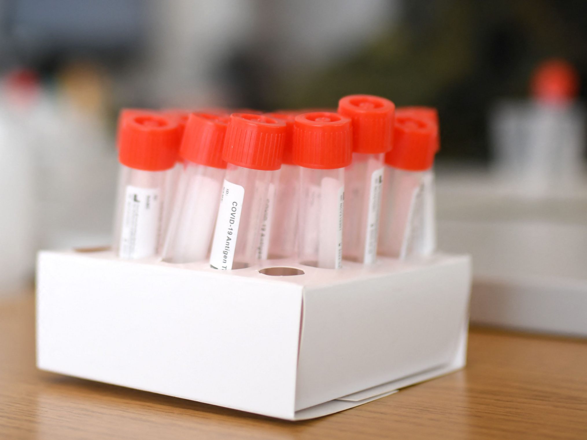 Die Anmeldung zum Corona-Test kommt - selbst, wenn man ohne Symptome dasteht. Die Anmeldung zum Corona-Test kommt - selbst, wenn man ohne Symptome dasteht.