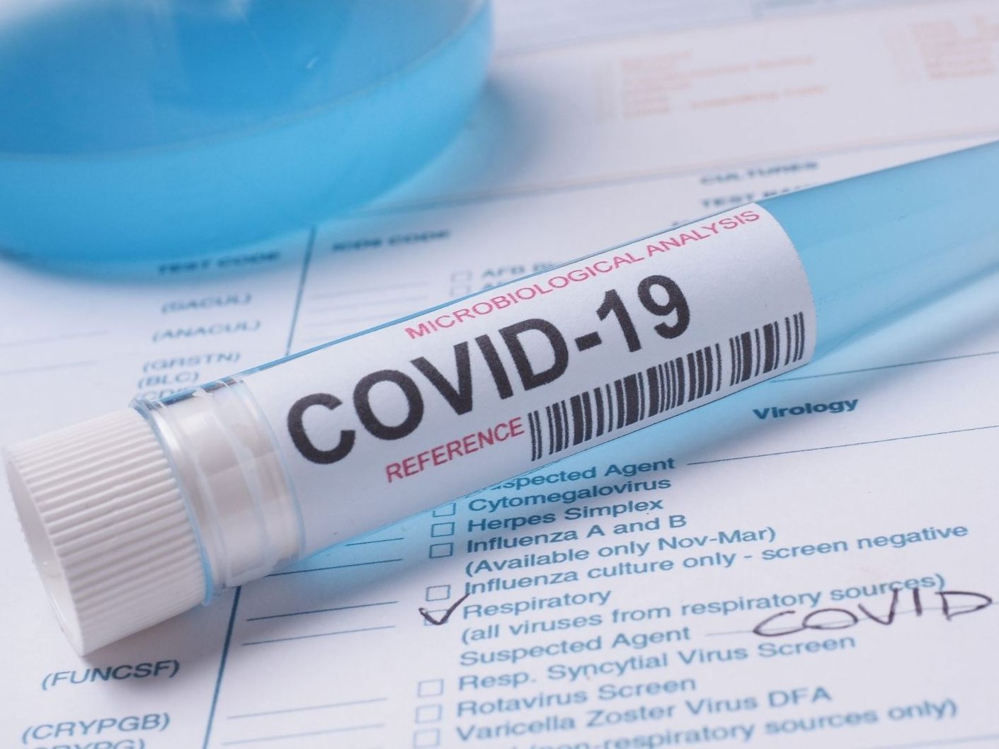 Es befinden sich 24 Covid-Patienten in Vorarlbergs Spitälern. Es befinden sich 24 Covid-Patienten in Vorarlbergs Spitälern.