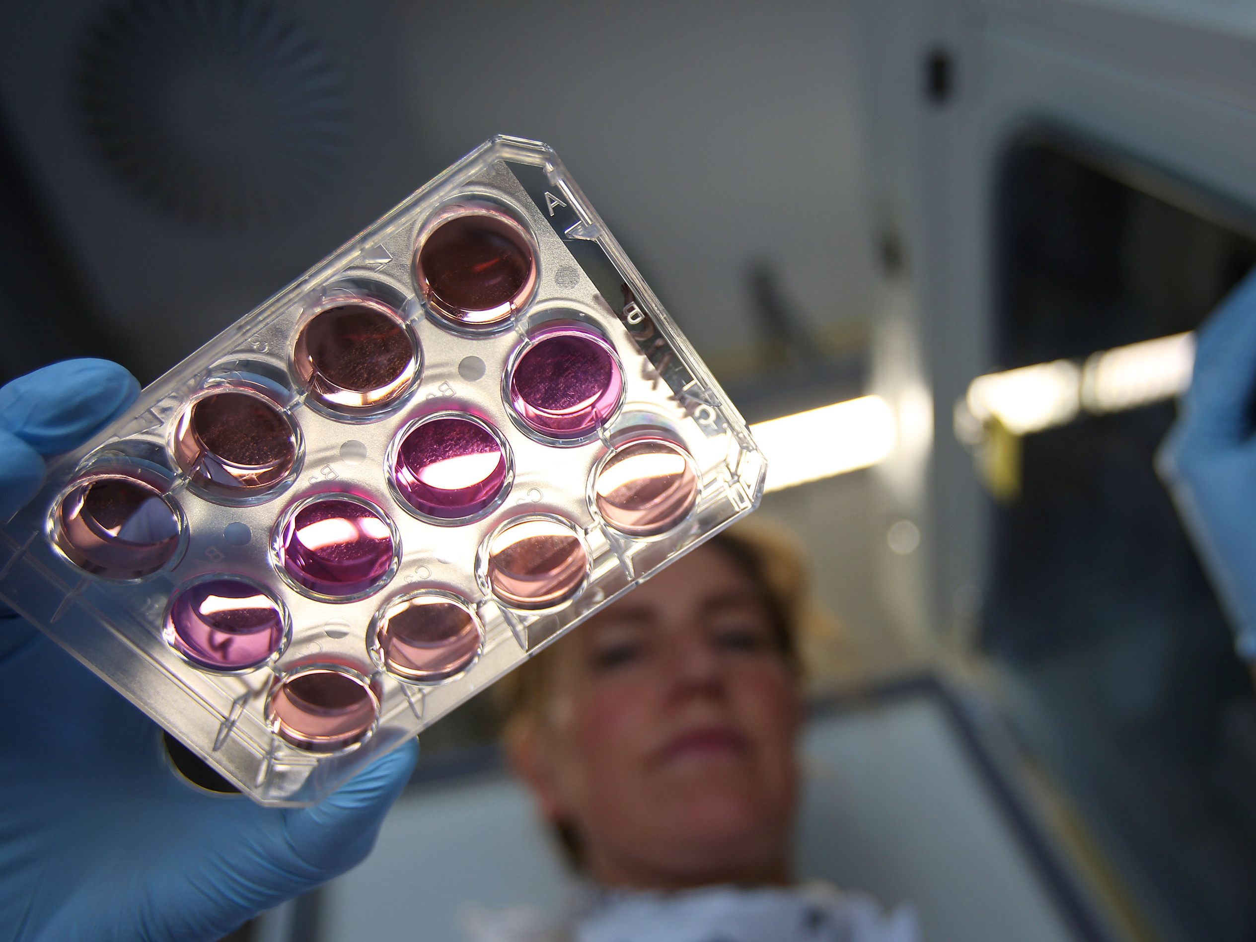 Wiener Biologin erhielt Preis für Forschung zu Zellkern-Fetttröpfchen. Wiener Biologin erhielt Preis für Forschung zu Zellkern-Fetttröpfchen.