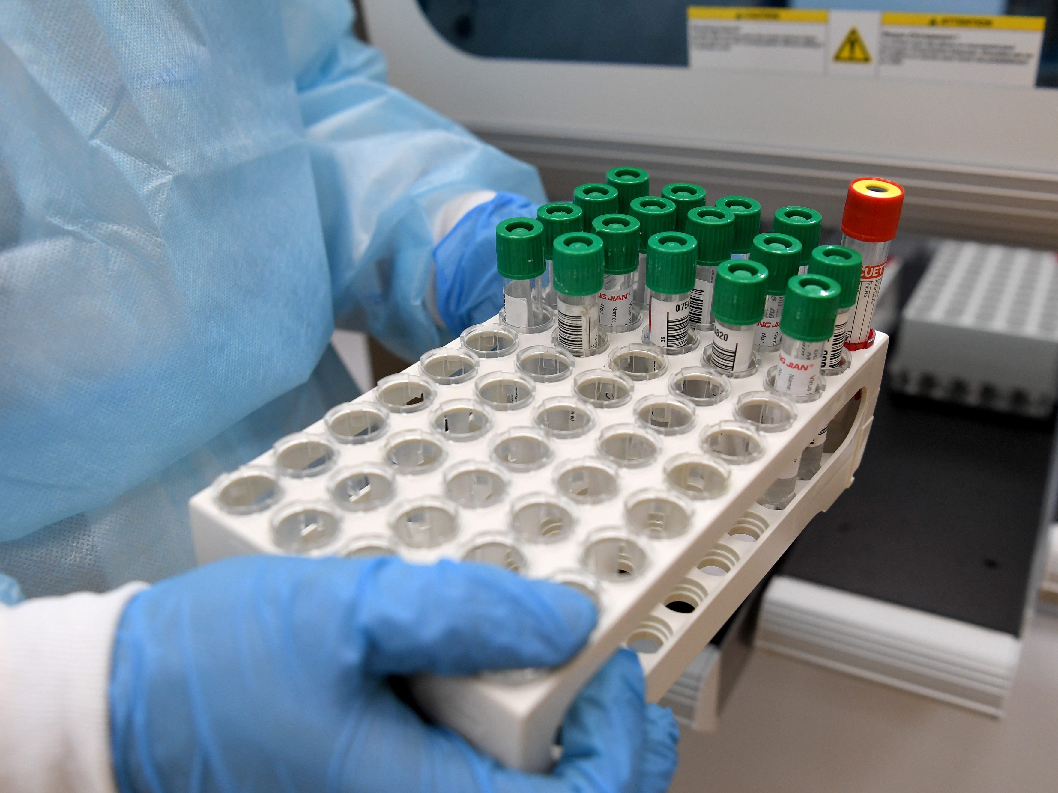 Verzögerungen bei Auswertungen von PCR-Tests. Verzögerungen bei Auswertungen von PCR-Tests.