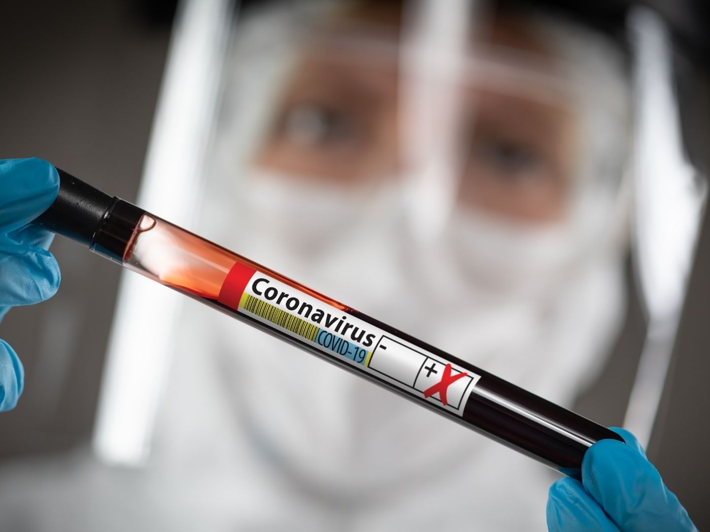 Der PCR-Test des Omikron-Verdachtsfalls ist positiv.