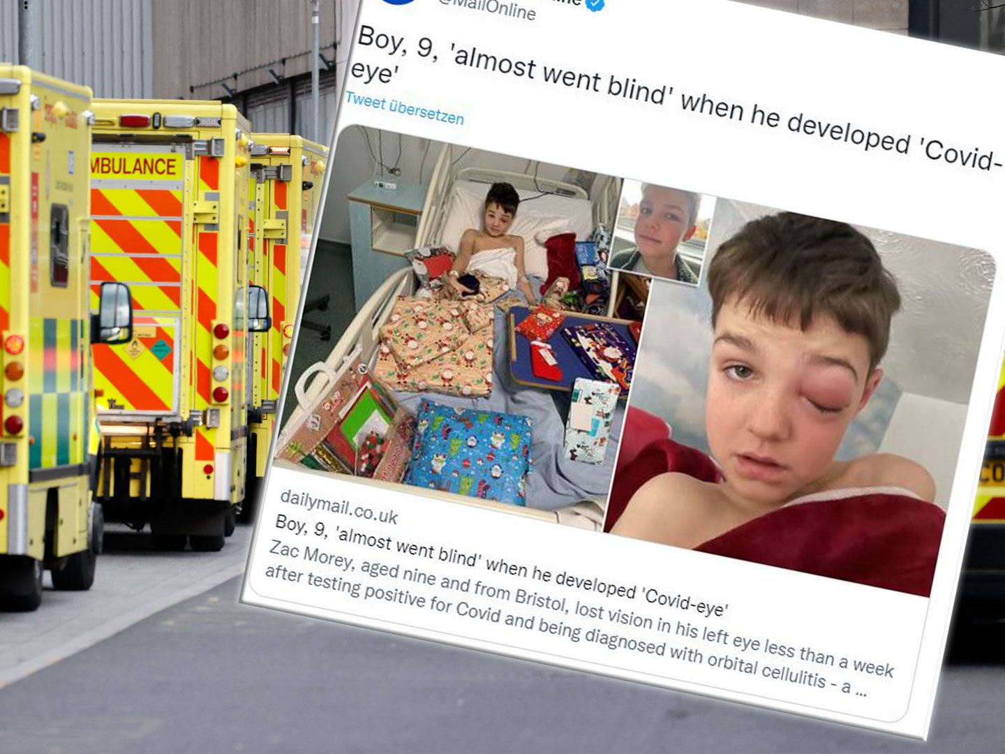 Der neunjährige Zac aus Großbritannien musste mit einem "Corona-Auge" ins Krankenhaus.