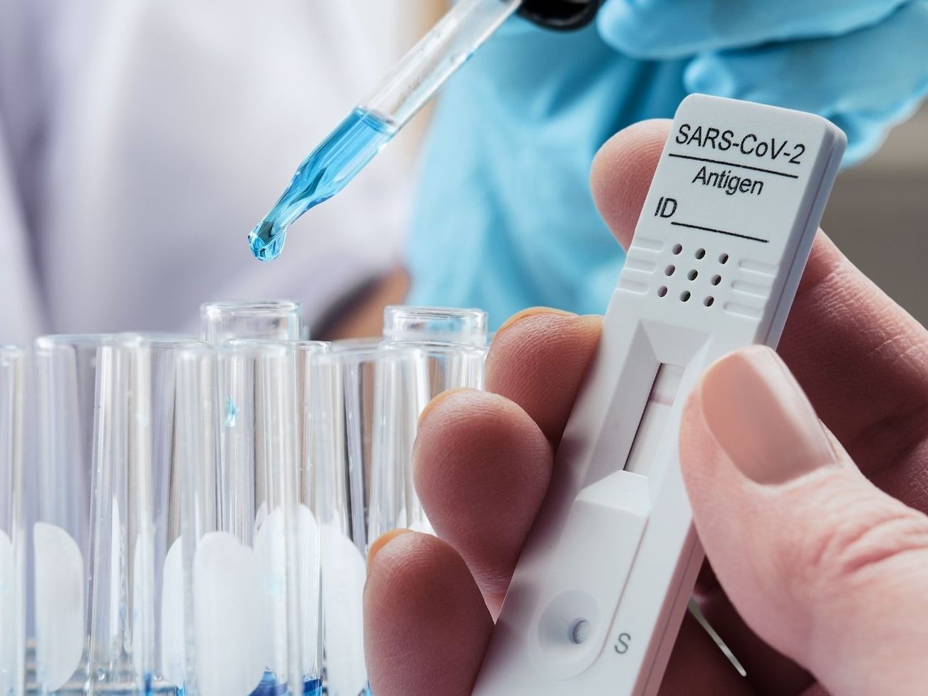 Die tatsächlichen Fallzahlen dürften deutlich höher sein.