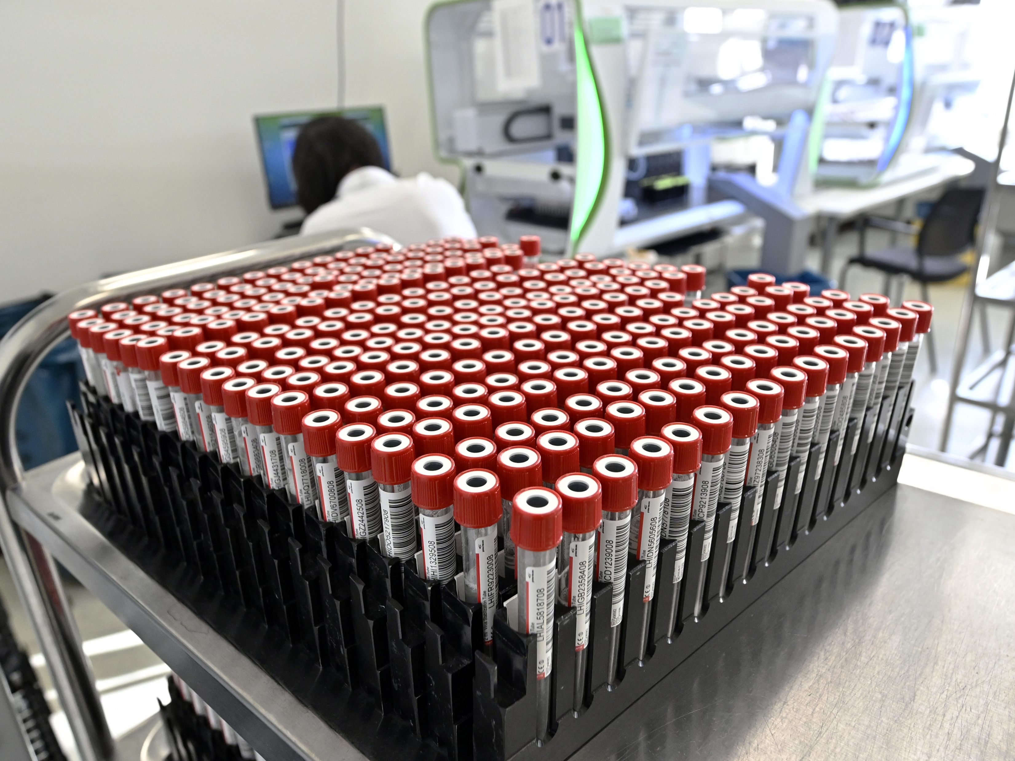 PCR-Tests kosten in Wien weniger, als in den Bundesländern. PCR-Tests kosten in Wien weniger, als in den Bundesländern.