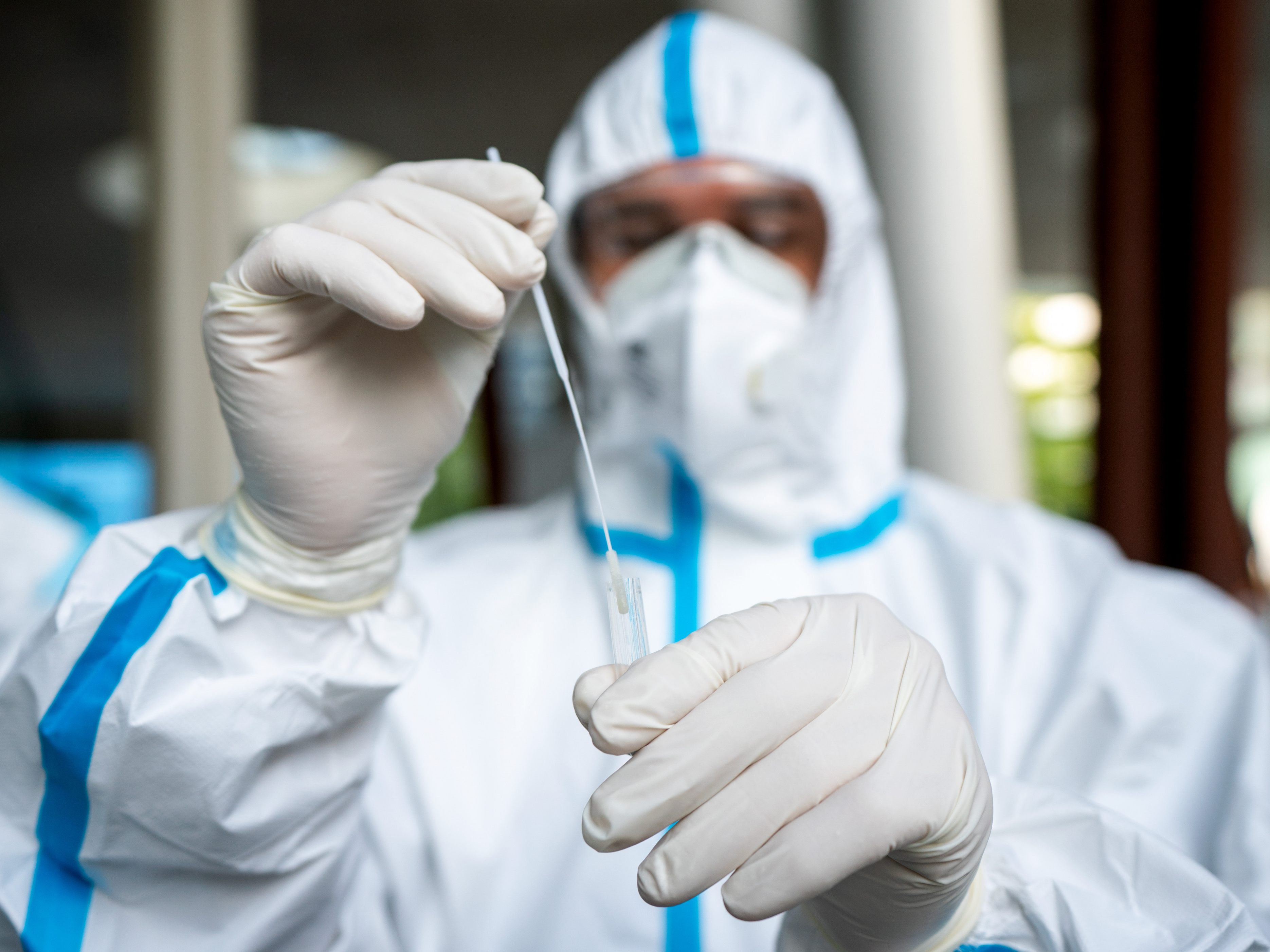 Am Sonntag wurden in Österreich 29.324 Coronavirus-Neuinfektionen gemeldet.