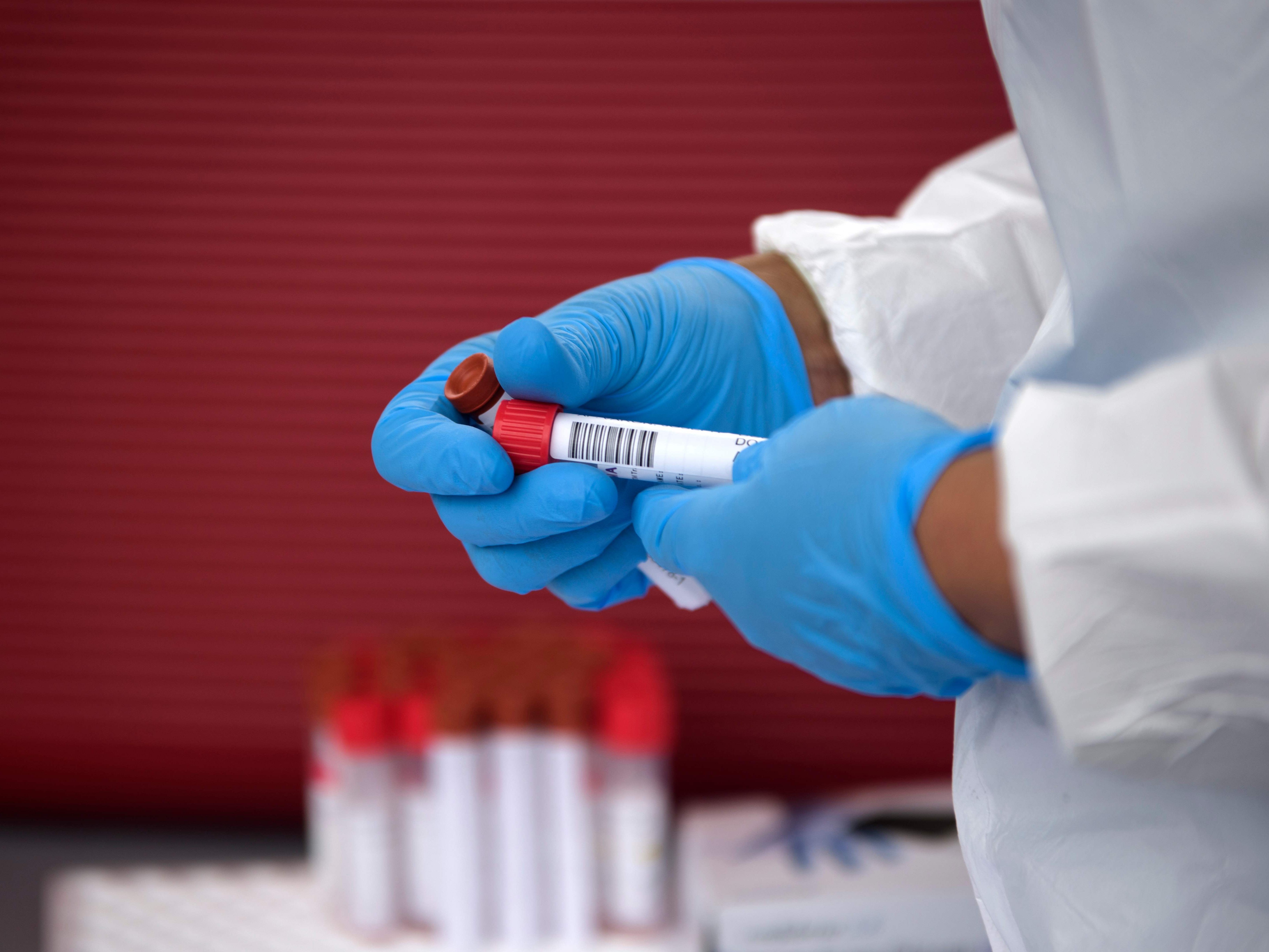 21,7 Prozent der Ungeimpften und Nicht-Genesenen mit dem Coronavirus infiziert 21,7 Prozent der Ungeimpften und Nicht-Genesenen mit dem Coronavirus infiziert