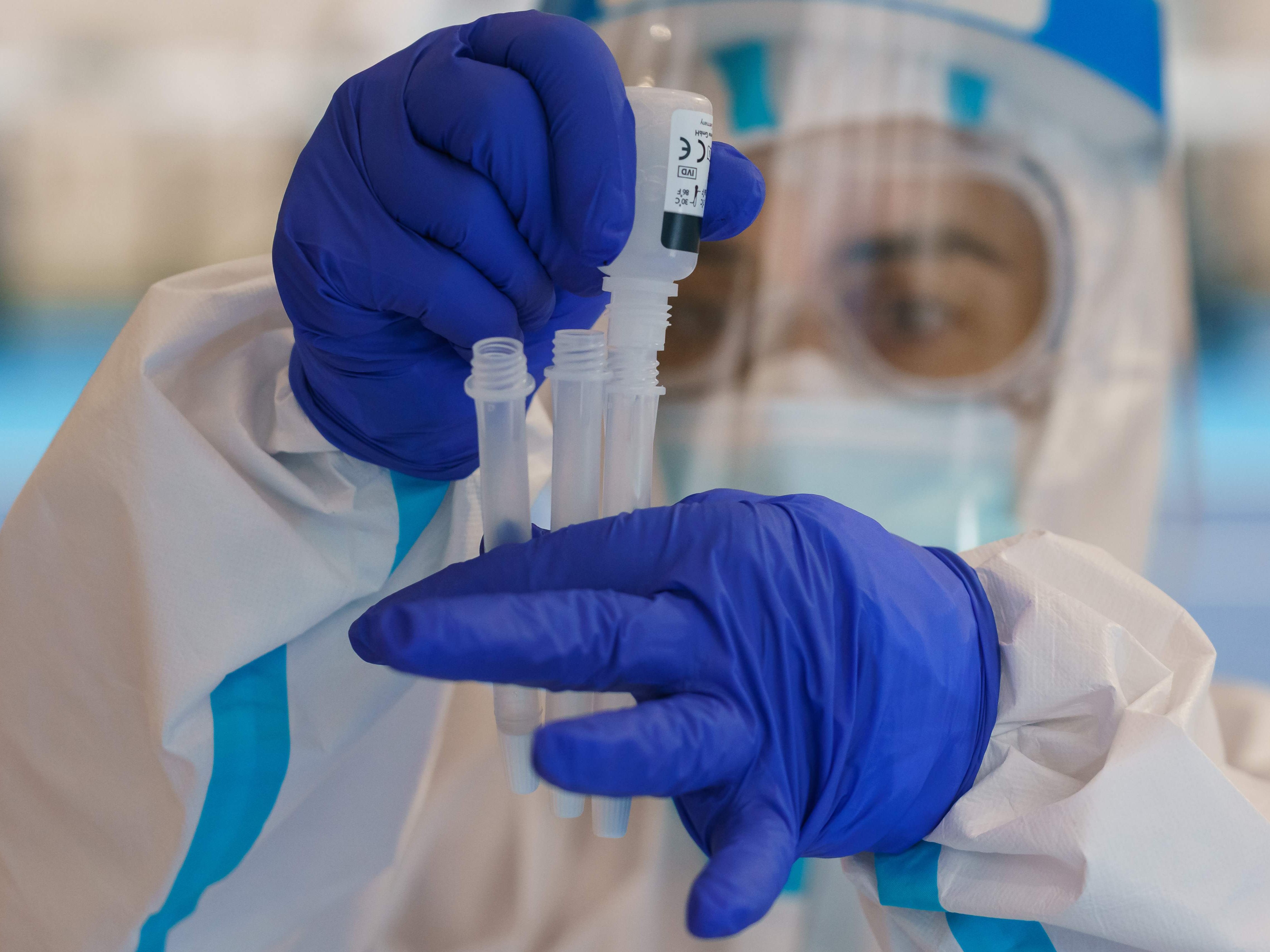 Aktuelle Zahlen zum Coronavirus am Samstag. Aktuelle Zahlen zum Coronavirus am Samstag.