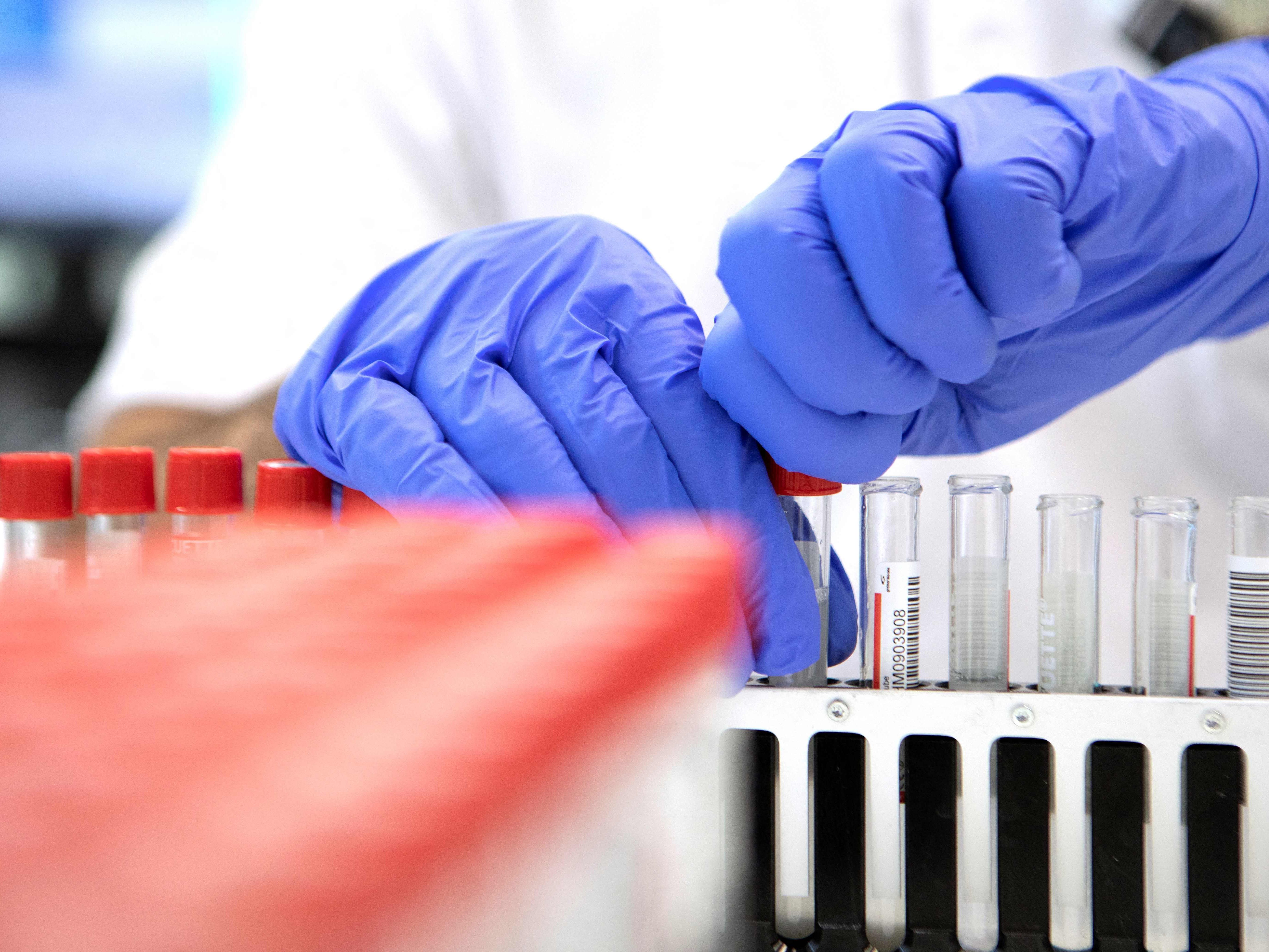 Coronavirus in Österreich
