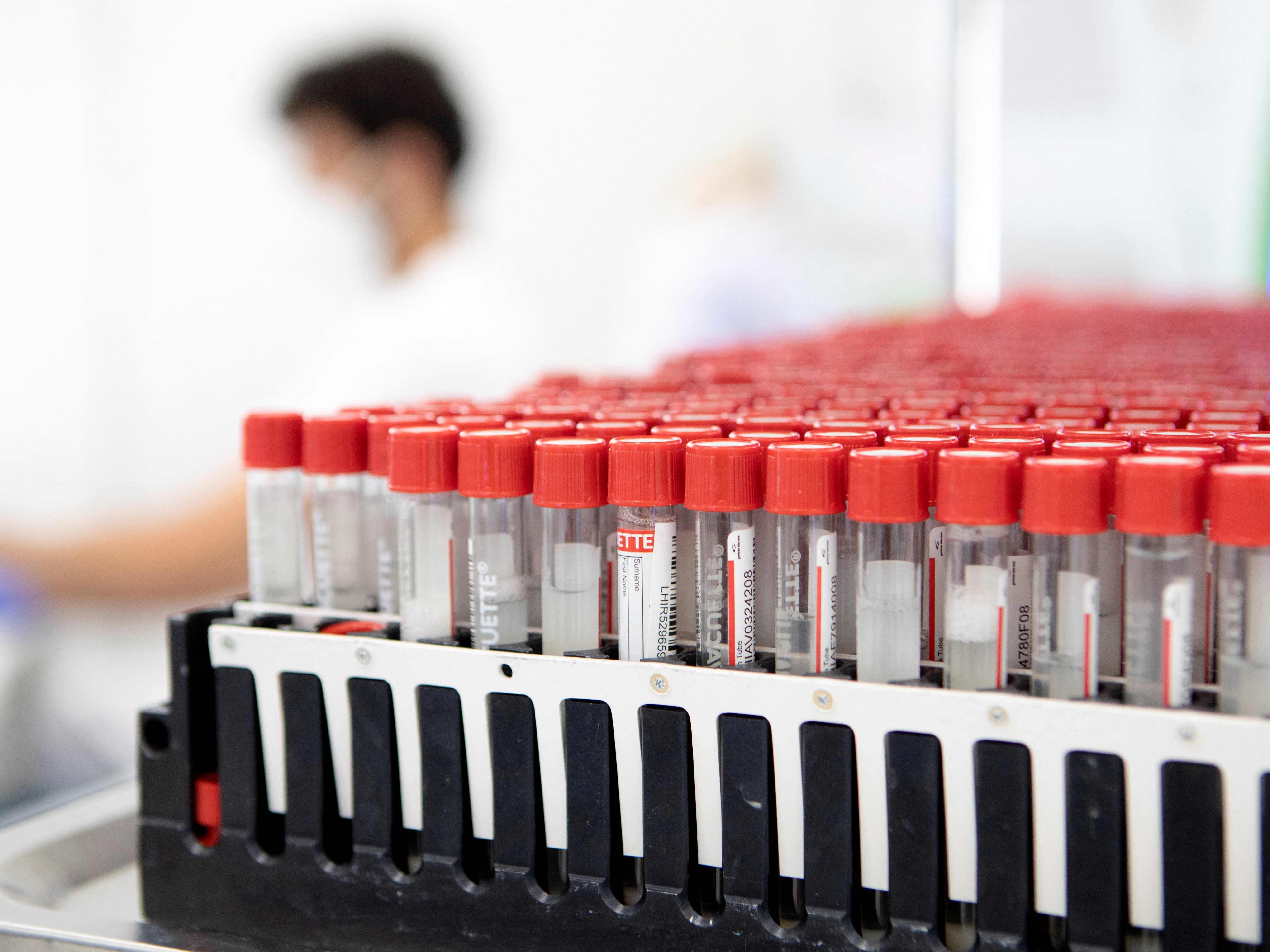 Die Corona-Teststrategie soll neu evaluiert werden.