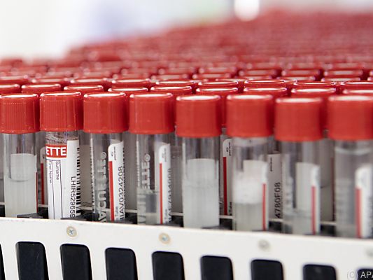 Positiv-Rate der PCR-Tests sei gestern bei 6,3 Prozent Positiv-Rate der PCR-Tests sei gestern bei 6,3 Prozent