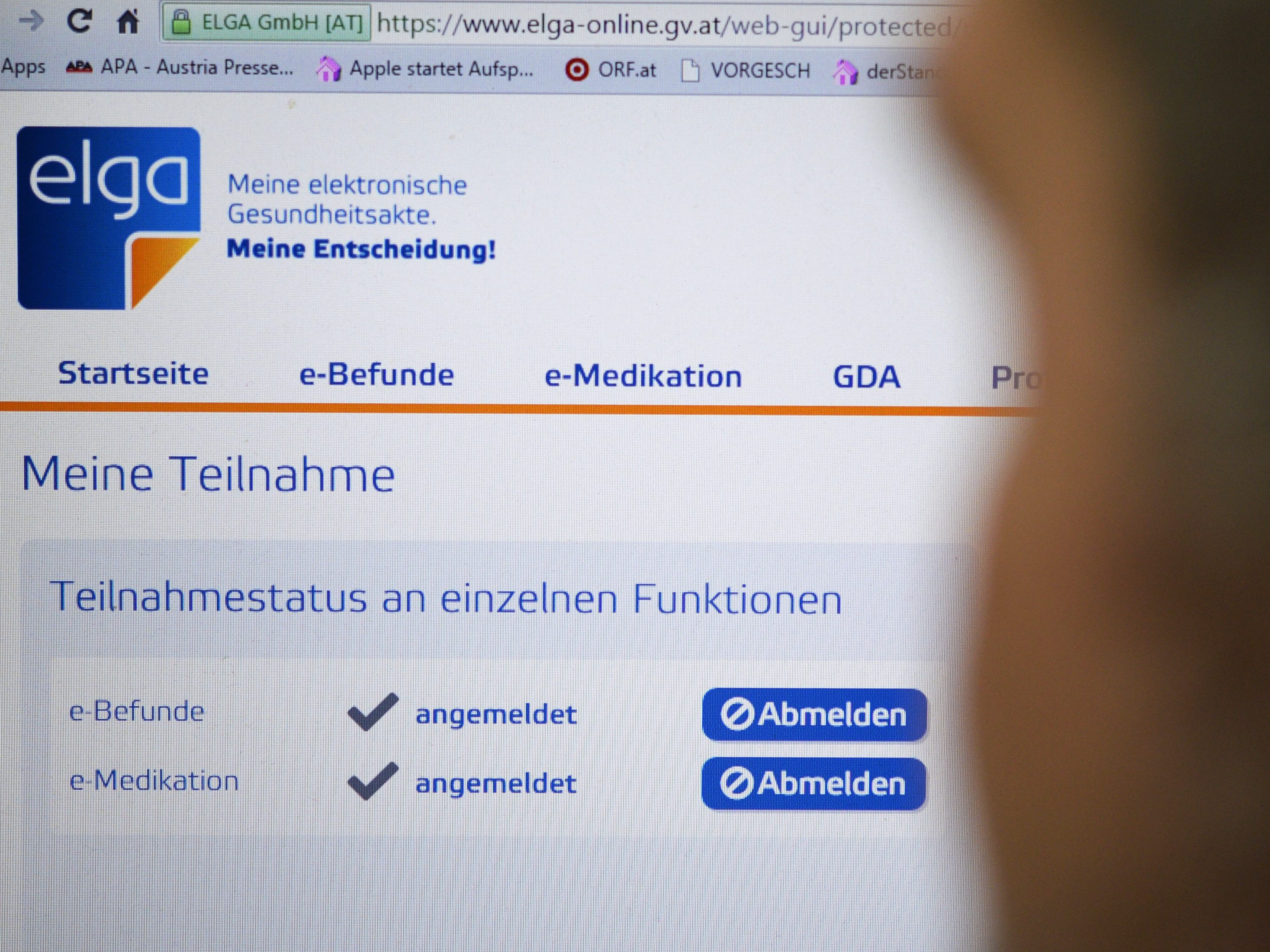 Experten kritisieren die schlechte Datenlage zu Long Covid in Österreich.