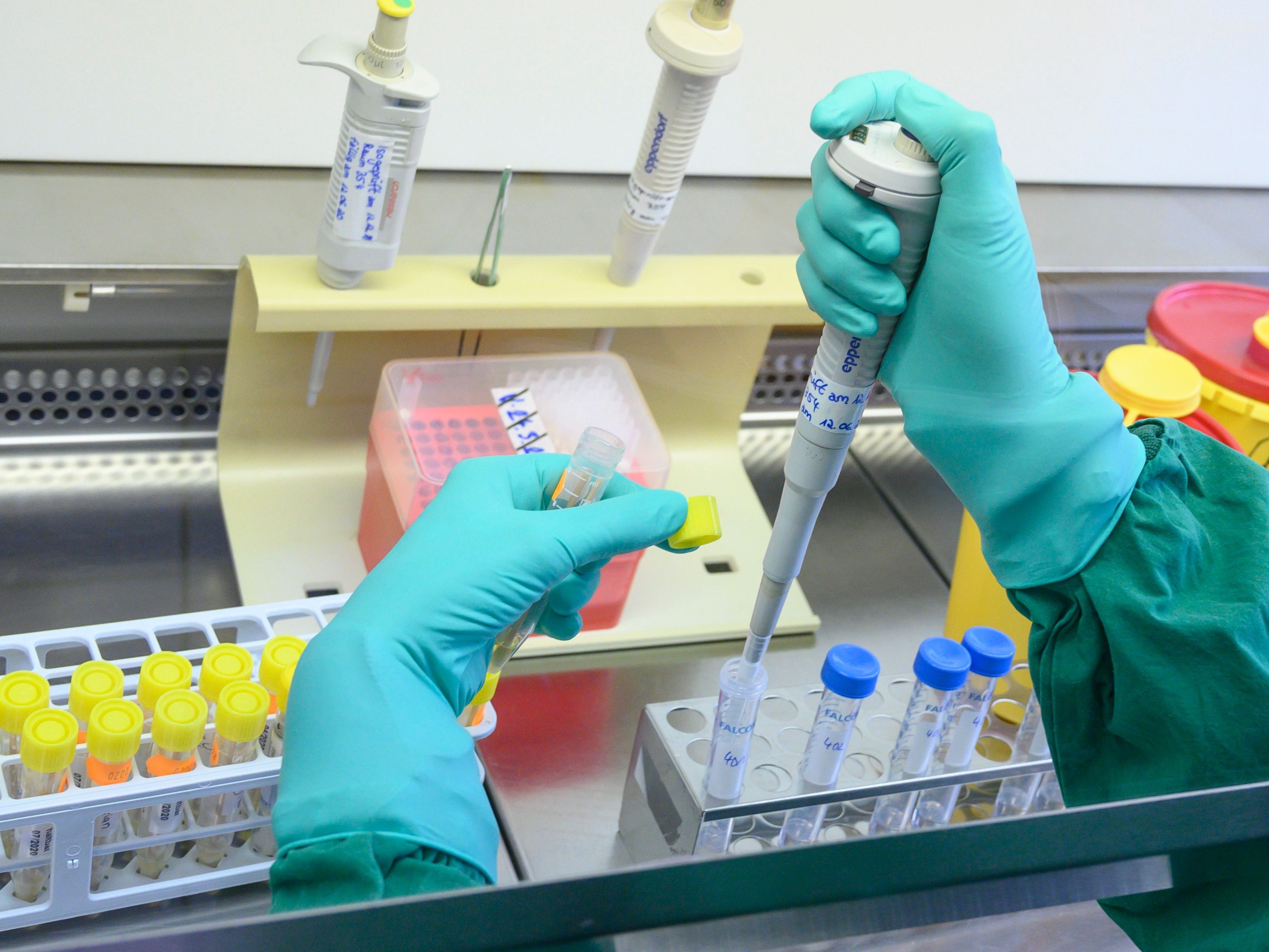 Erster mysteriöser Hepatitisfall bei Kind in Deutschland. Erster mysteriöser Hepatitisfall bei Kind in Deutschland.