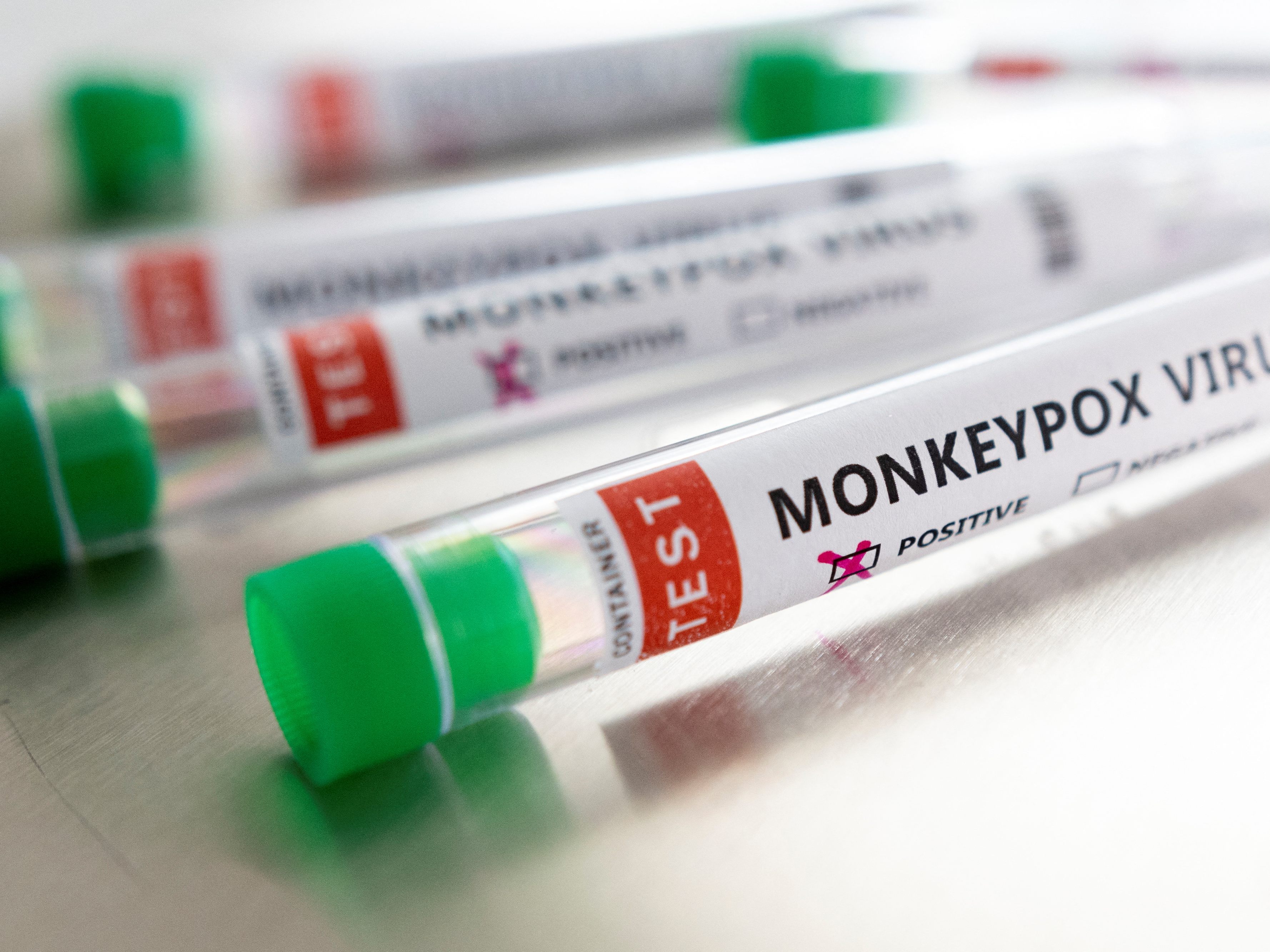 Affenpocken: UNAIDS-Kritik an einigen Berichten. Affenpocken: UNAIDS-Kritik an einigen Berichten.