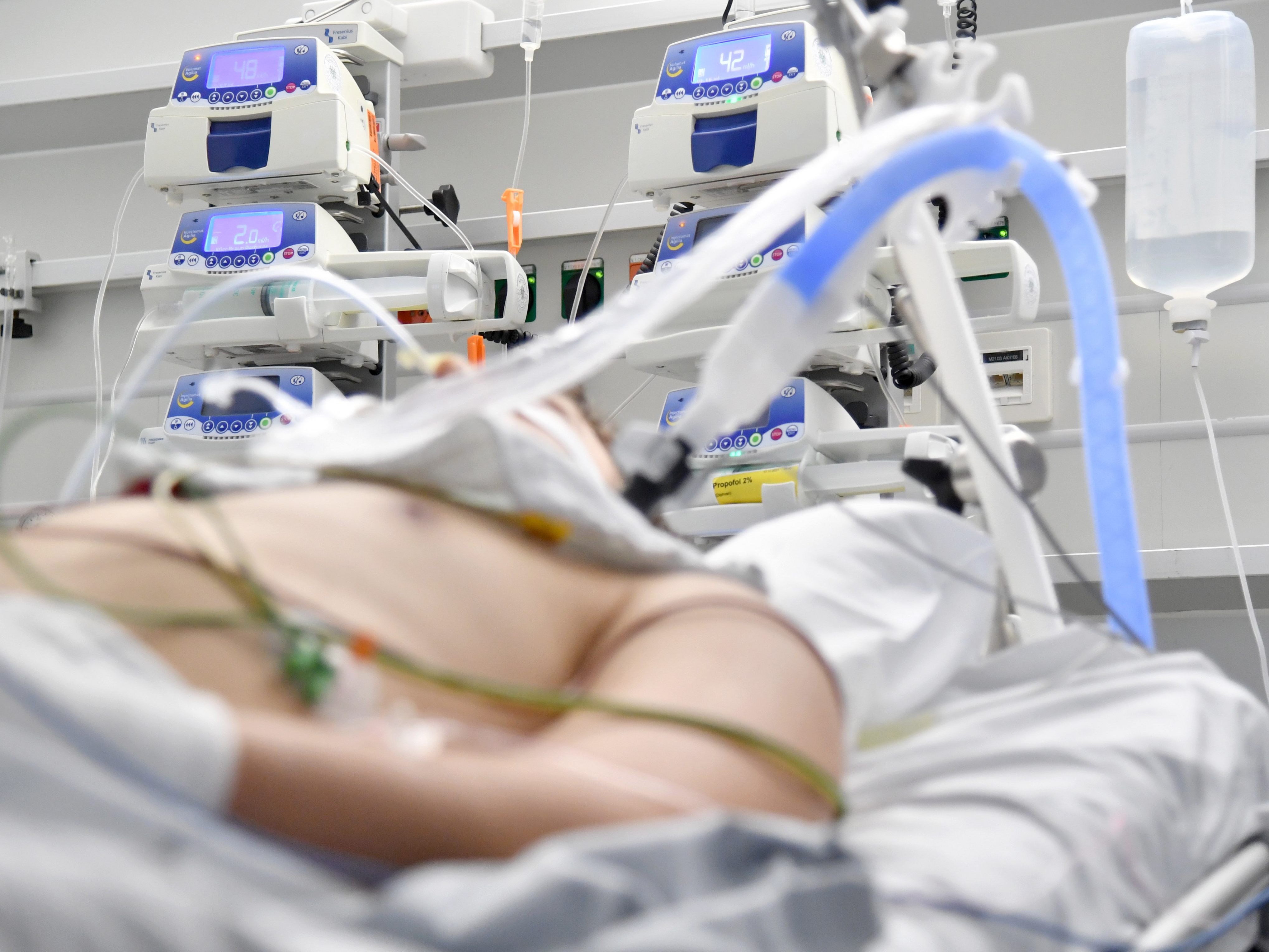 Eine Infektion mit dem Coronavirus erhöhrt die Gefahr für Atemprobleme und Lungenembolie Eine Infektion mit dem Coronavirus erhöhrt die Gefahr für Atemprobleme und Lungenembolie