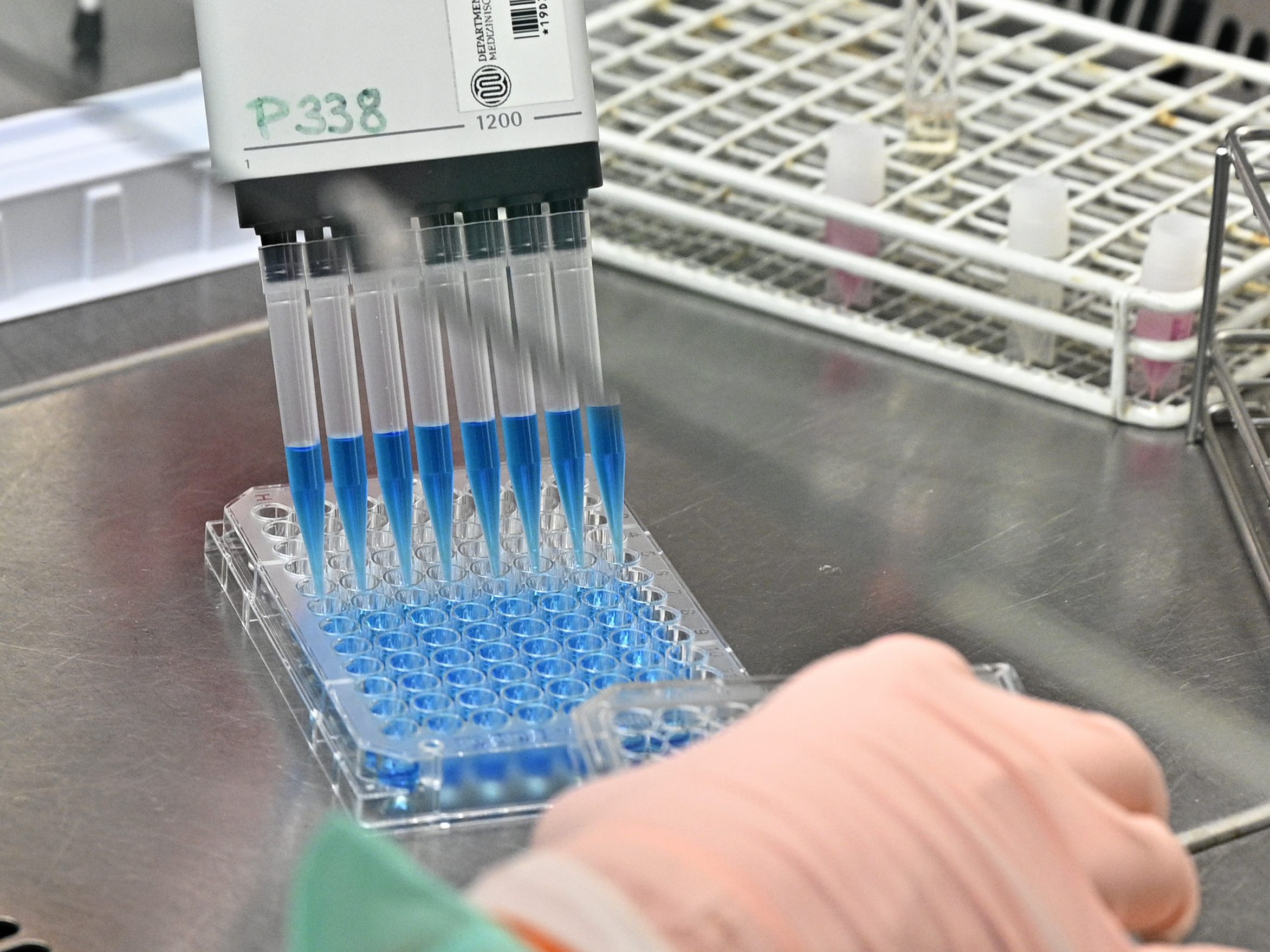 Spezialzentren sollen die Diagnose seltener Erkrankungen beschleunigen Spezialzentren sollen die Diagnose seltener Erkrankungen beschleunigen