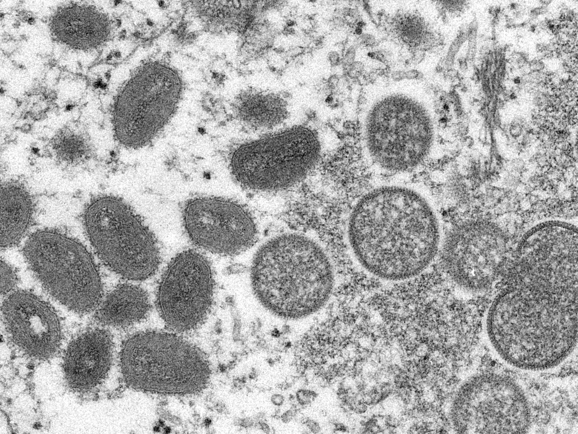Britische Behörde: Drei Wochen Quarantäne bei Kontakt mit Affenpocken-Infizierten. Britische Behörde: Drei Wochen Quarantäne bei Kontakt mit Affenpocken-Infizierten.