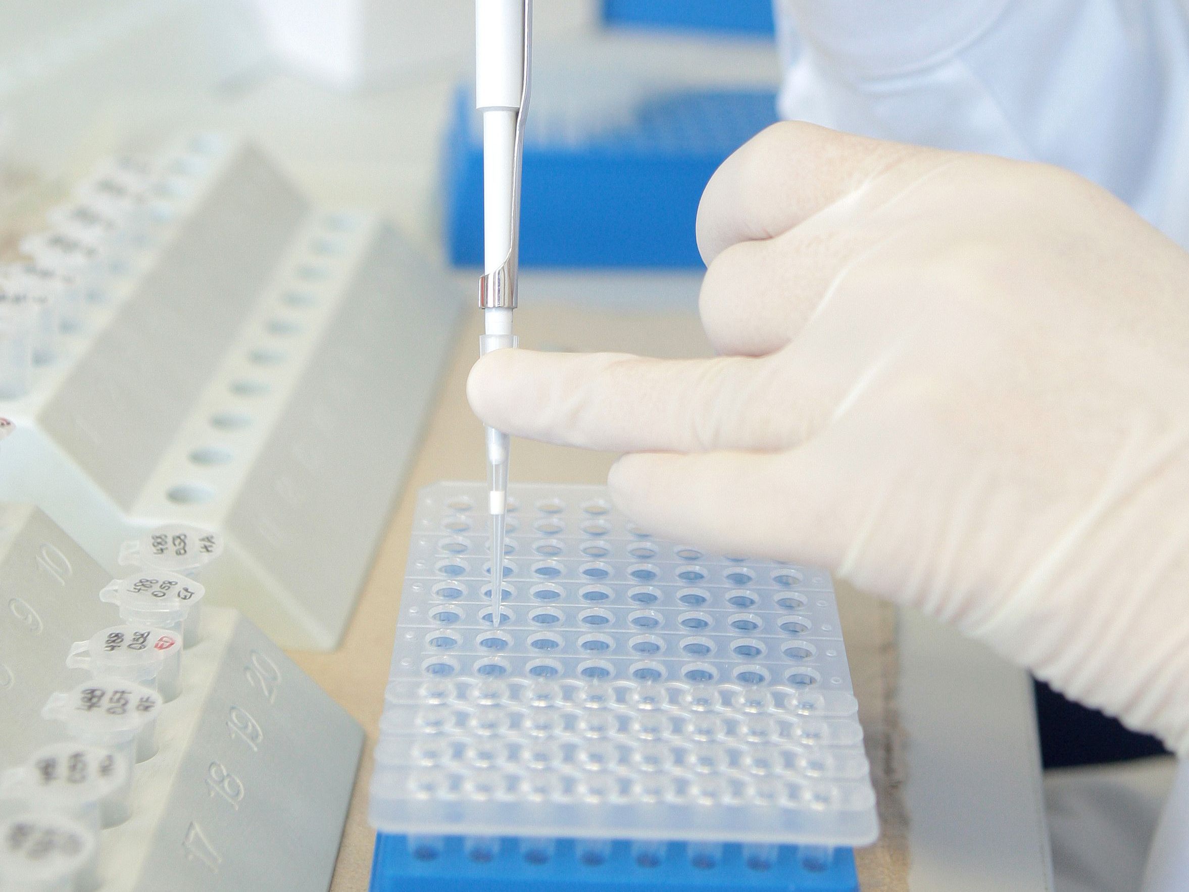 WHO-Experten fordern die Prüfung der Laborthese zum Ursprung des Coronavirus.