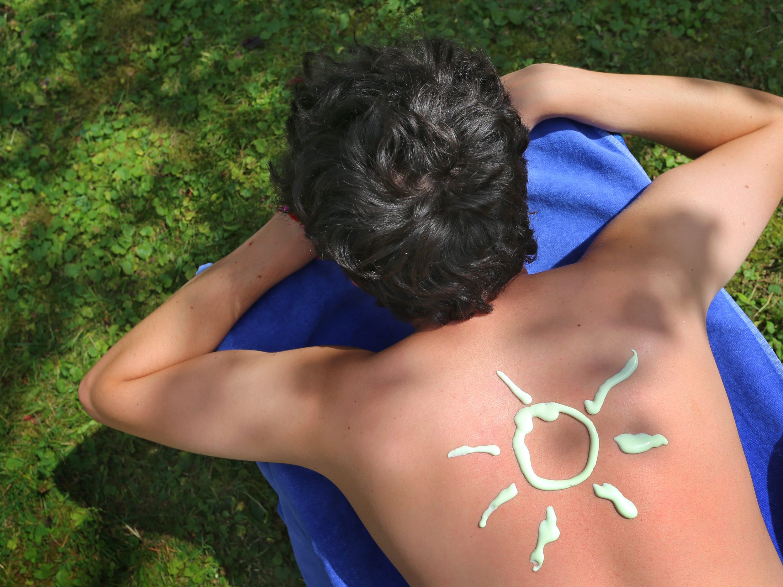 Diese Tipps helfen wirklich bei Sonnenbrand. Diese Tipps helfen wirklich bei Sonnenbrand.