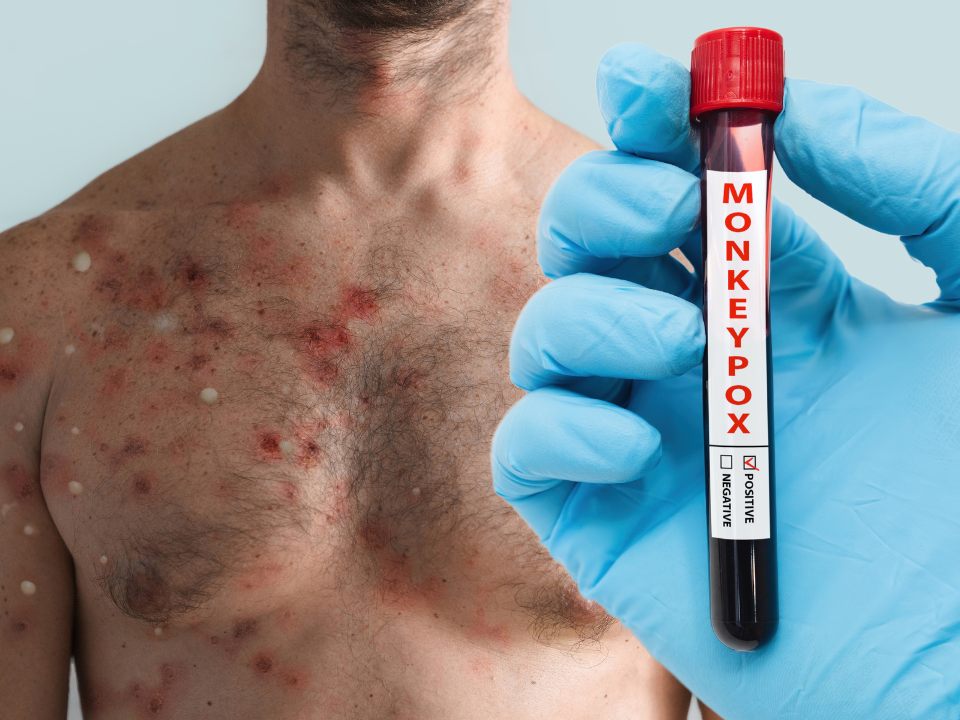 Zuvor Brasilien hatte über einen Todesfall durch das Virus berichtet Zuvor Brasilien hatte über einen Todesfall durch das Virus berichtet